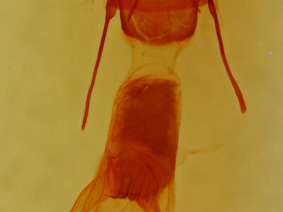 genitalia view of adult Anorthodes triquetra 