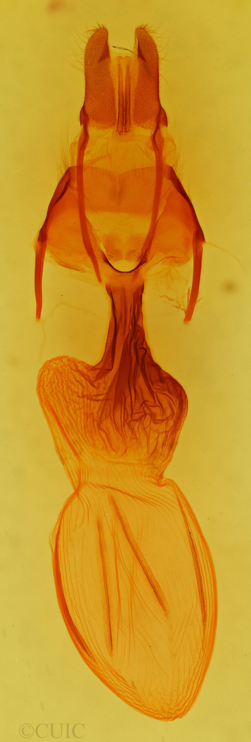 genitalia view of adult Apamea amputatrix