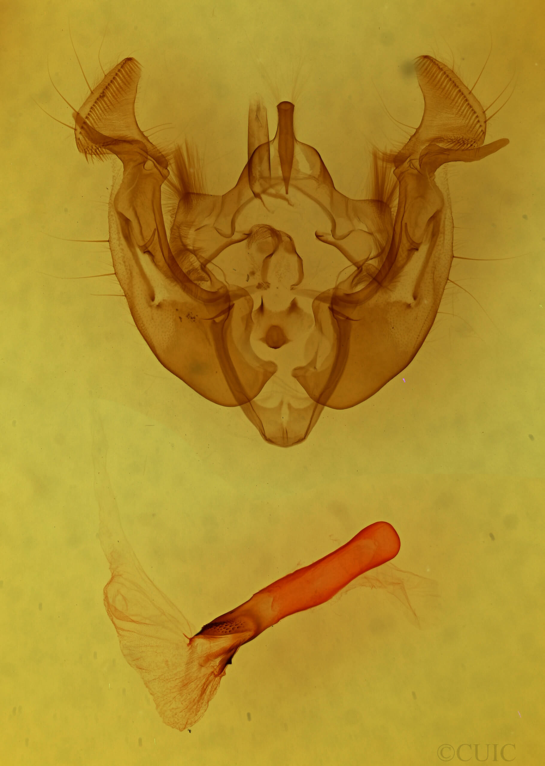 genitalia view of adult Apamea commoda striolata