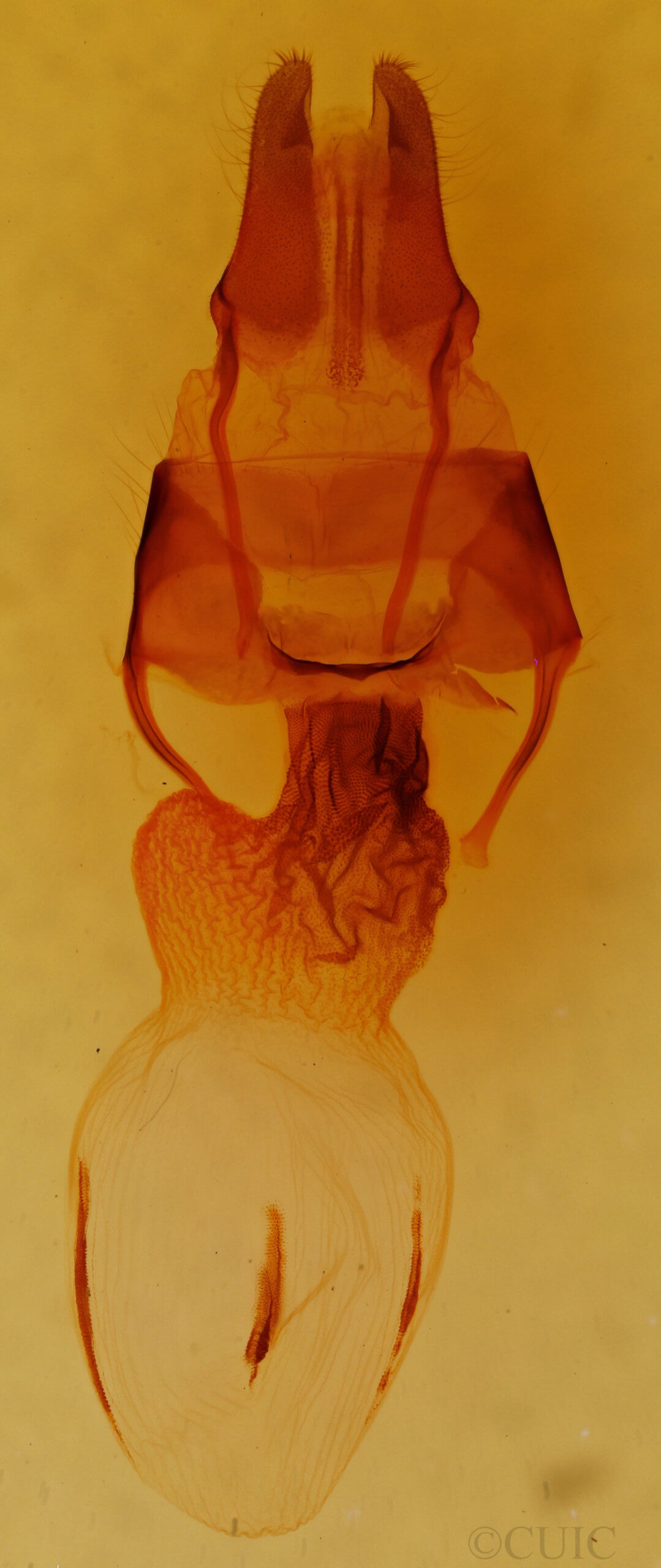 genitalia view of adult Apamea commoda striolata