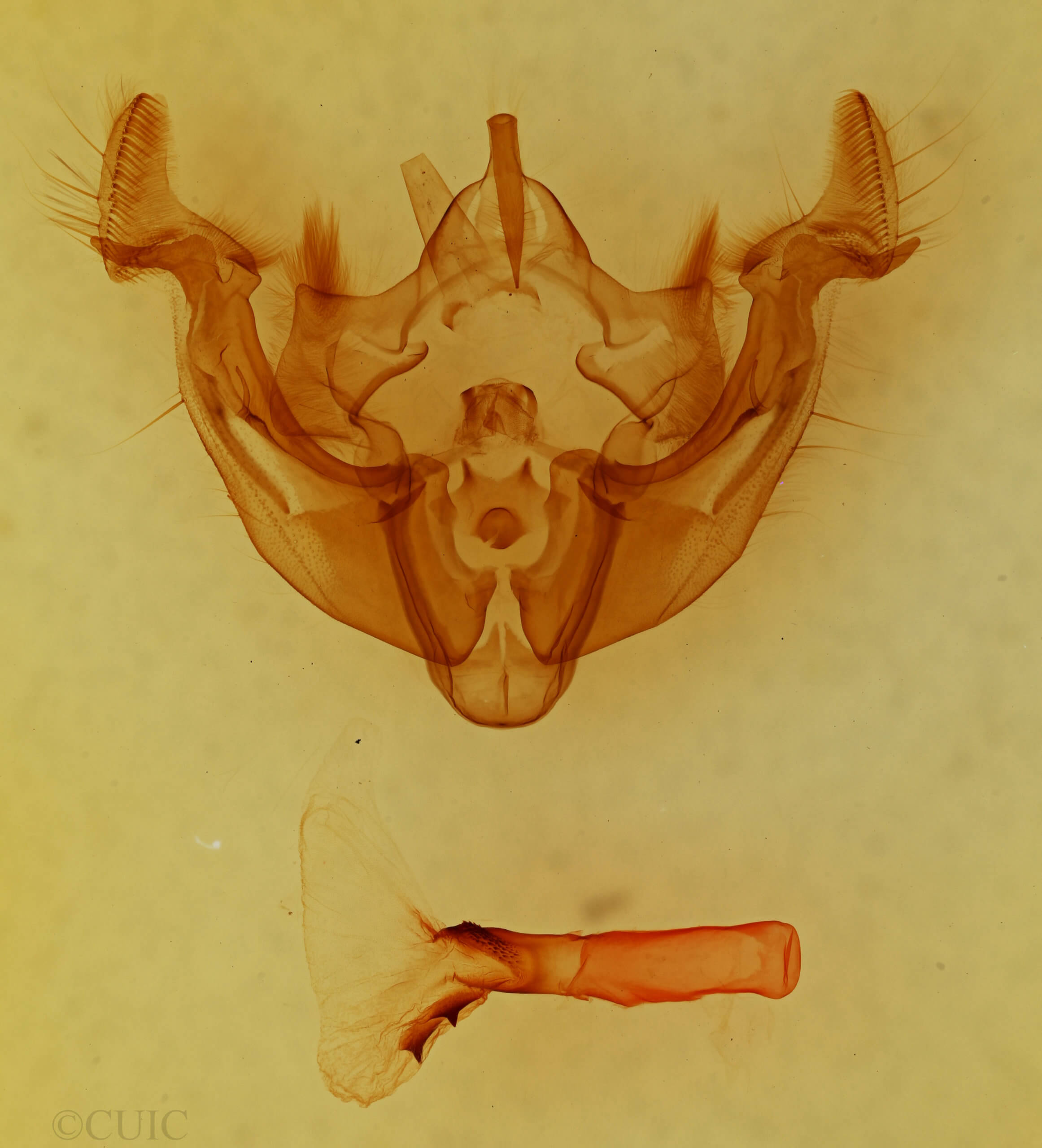 genitalia view of adult Apamea commoda striolata