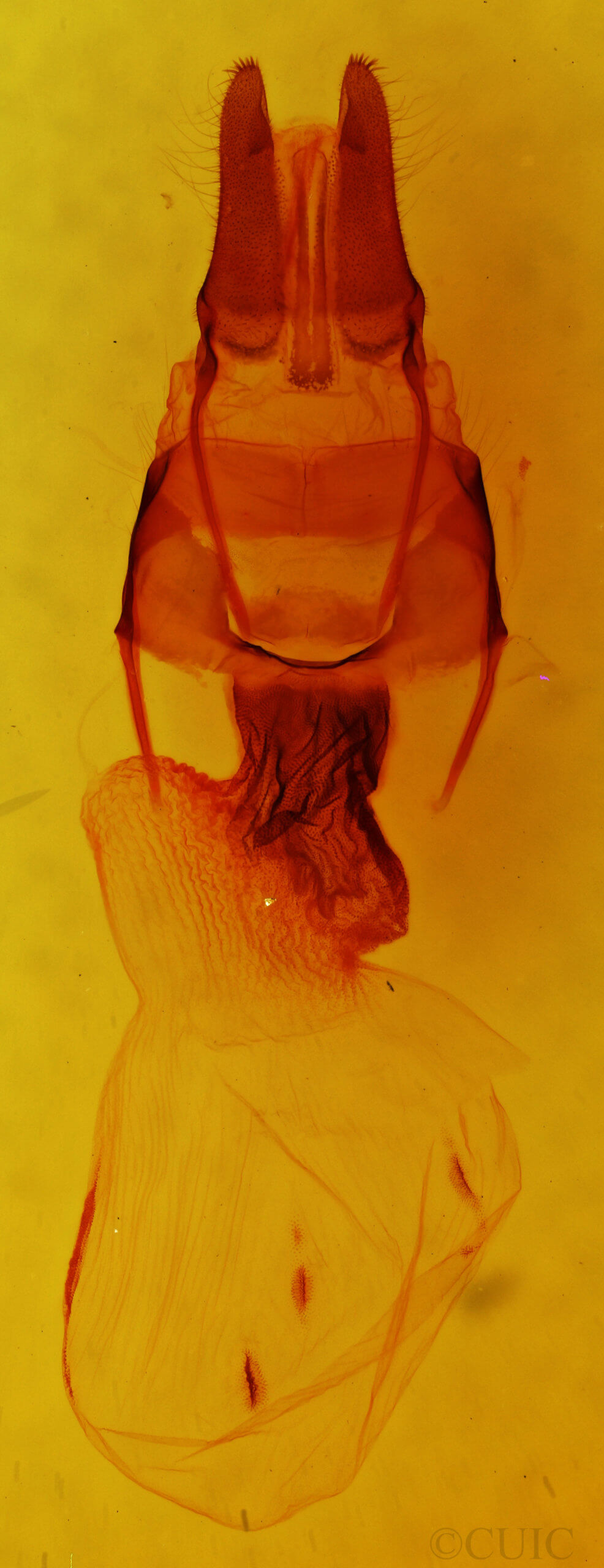 genitalia view of adult Apamea commoda striolata