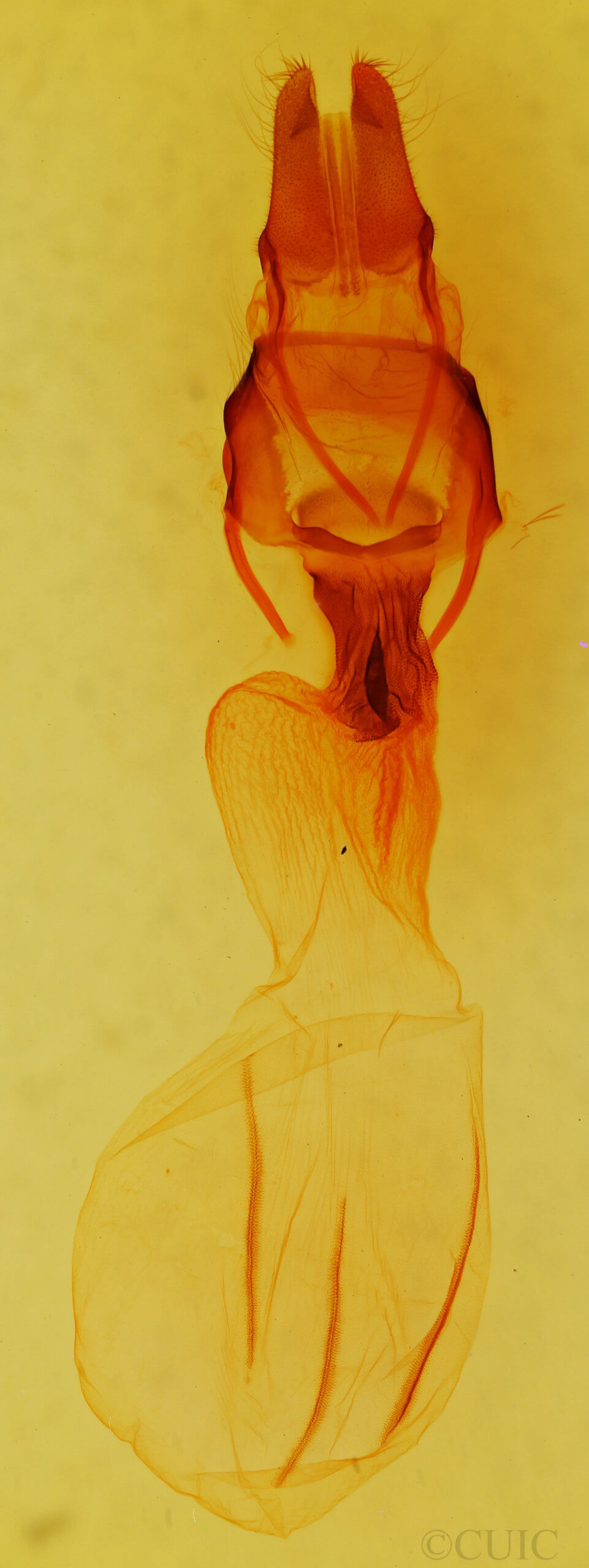 genitalia view of adult Apamea devastator