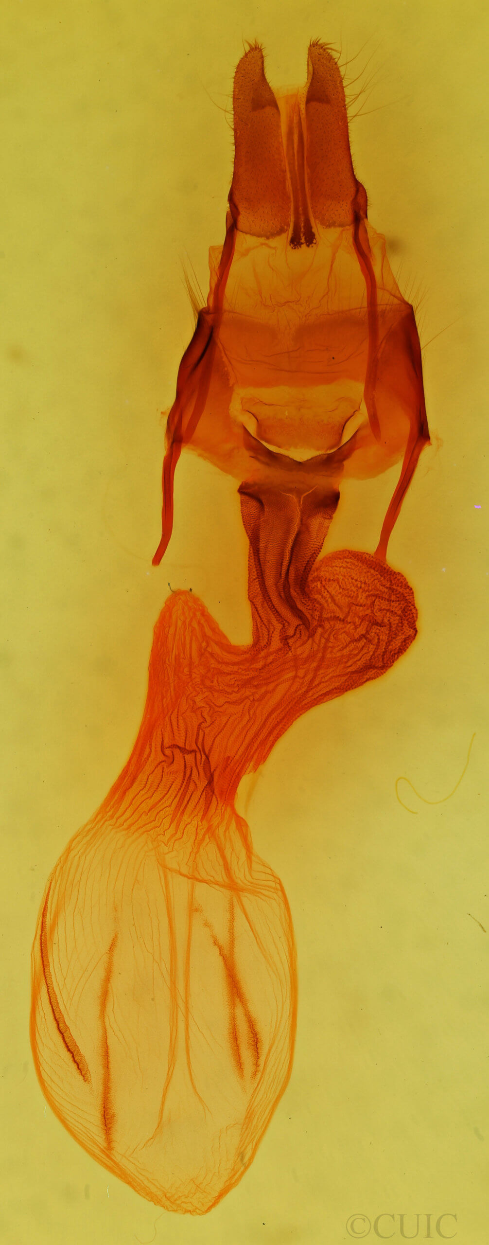 genitalia view of adult Apamea dubitans