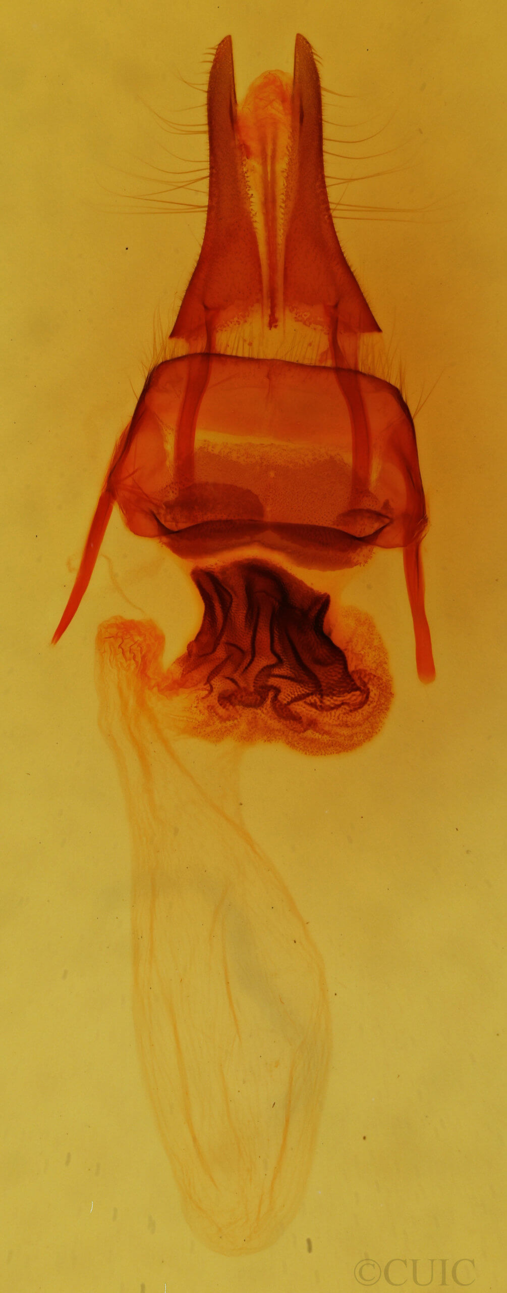 genitalia view of adult Apamea sordens finitima