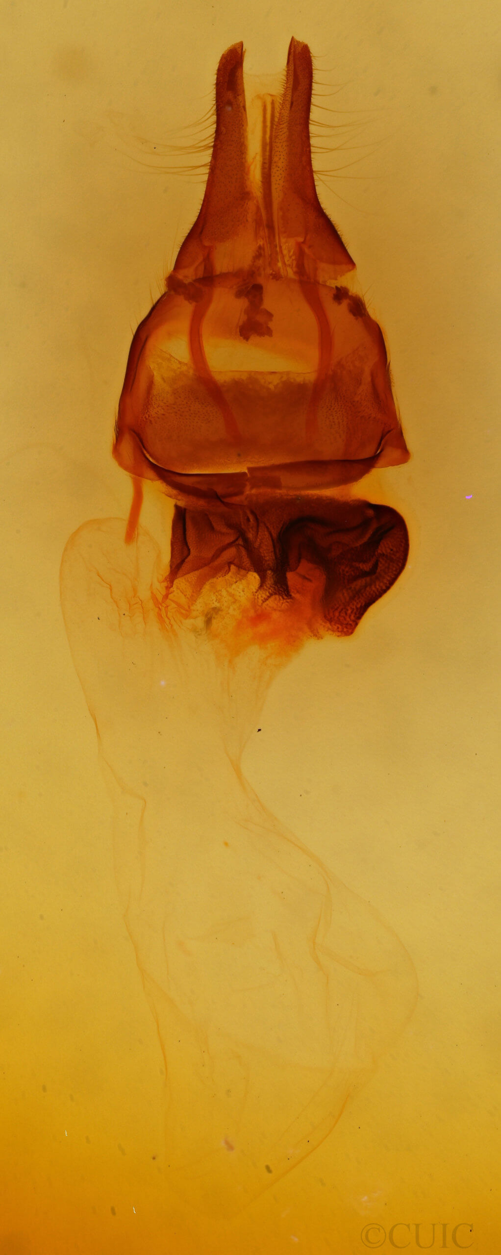 genitalia view of adult Apamea sordens finitima