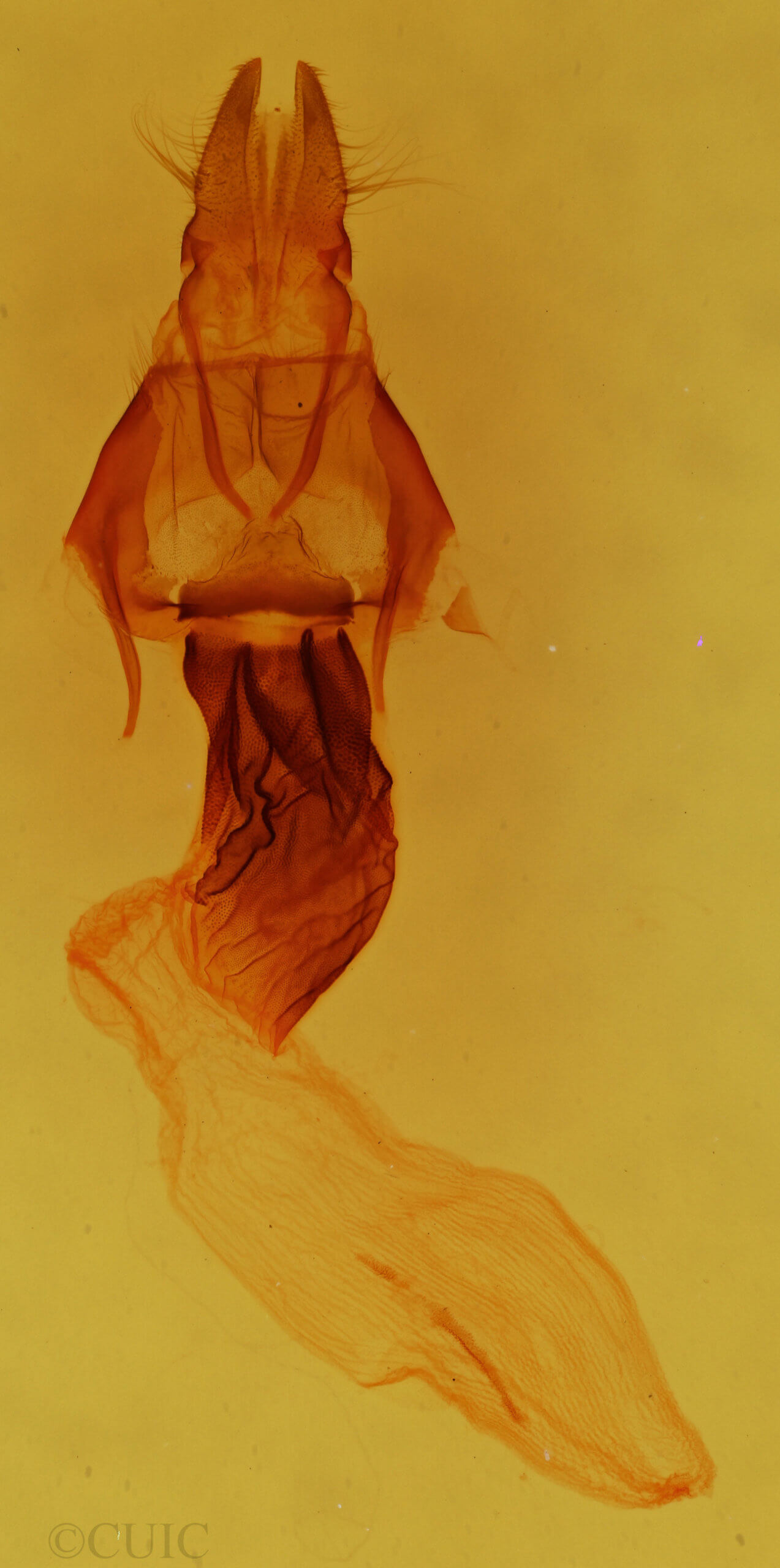 genitalia view of adult Apamea impulsa