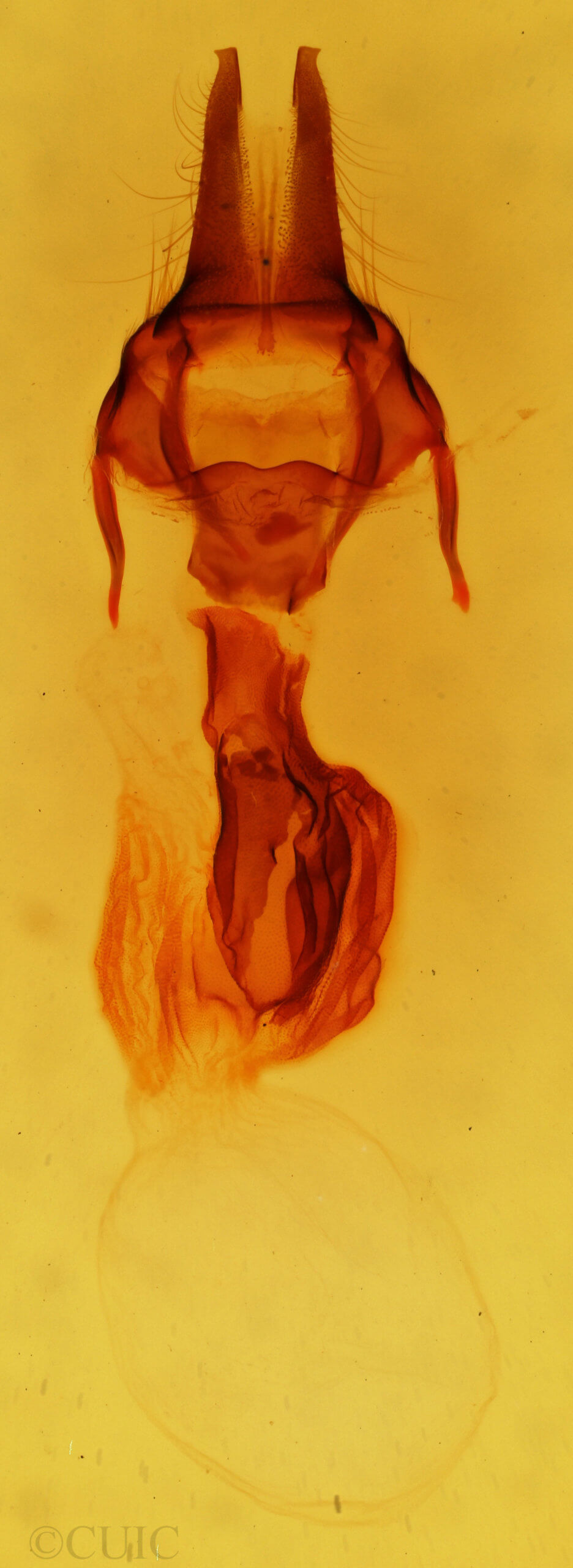 genitalia view of adult Apamea inordinata semilunata