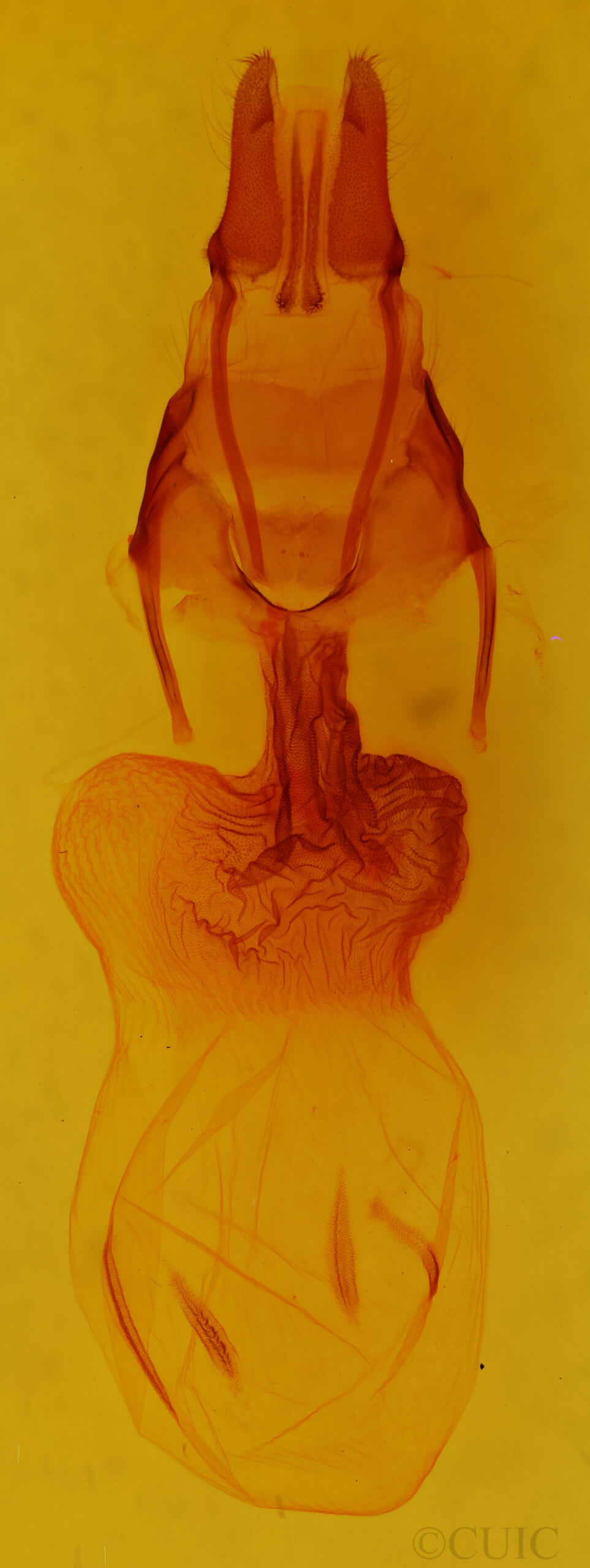 genitalia view of adult Apamea lignicolora