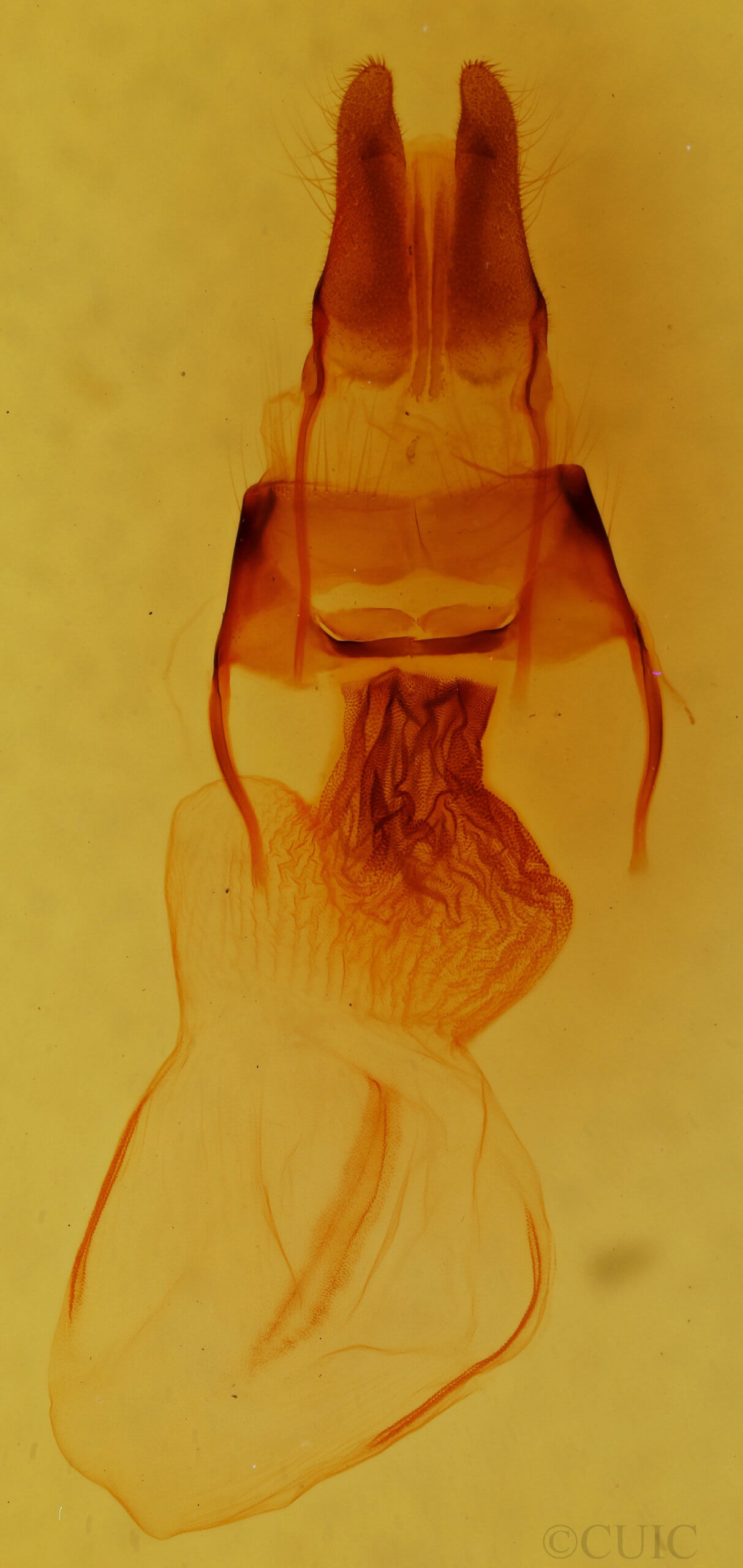 genitalia view of adult Apamea longula
