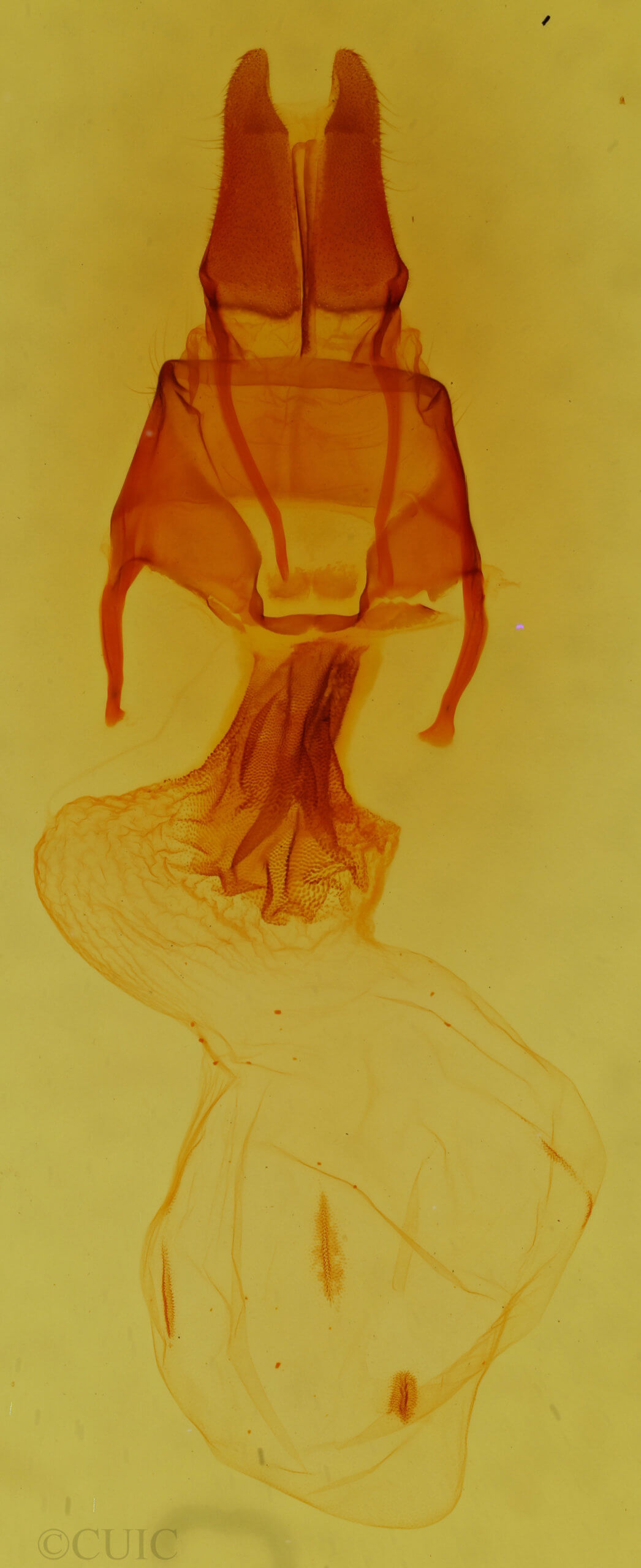 genitalia view of adult Apamea lutosa