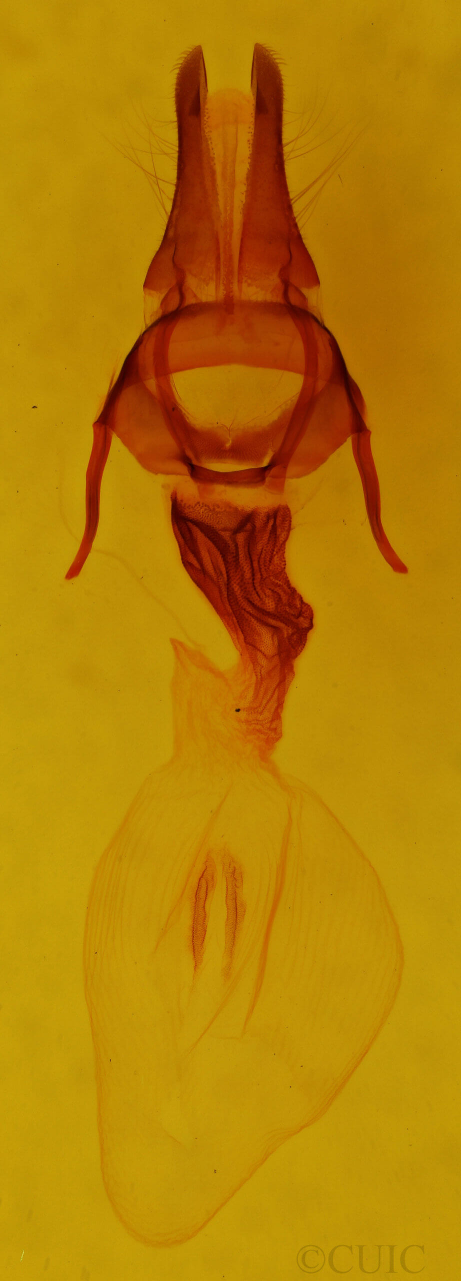 genitalia view of adult Apamea perpensa