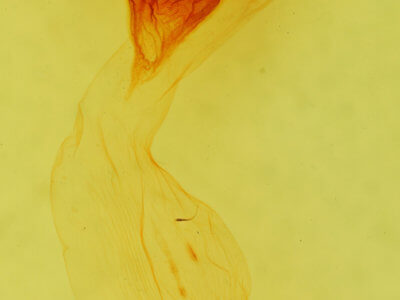 genitalia view of adult Apamea plutonia