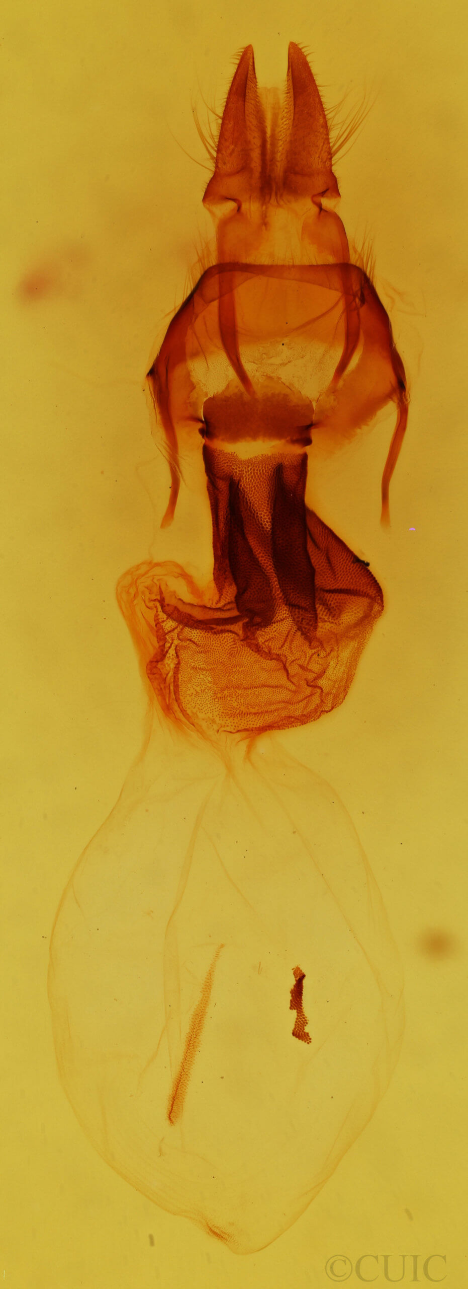 genitalia view of adult Apamea unita