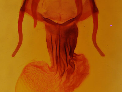 genitalia view of adult Apamea vulgaris