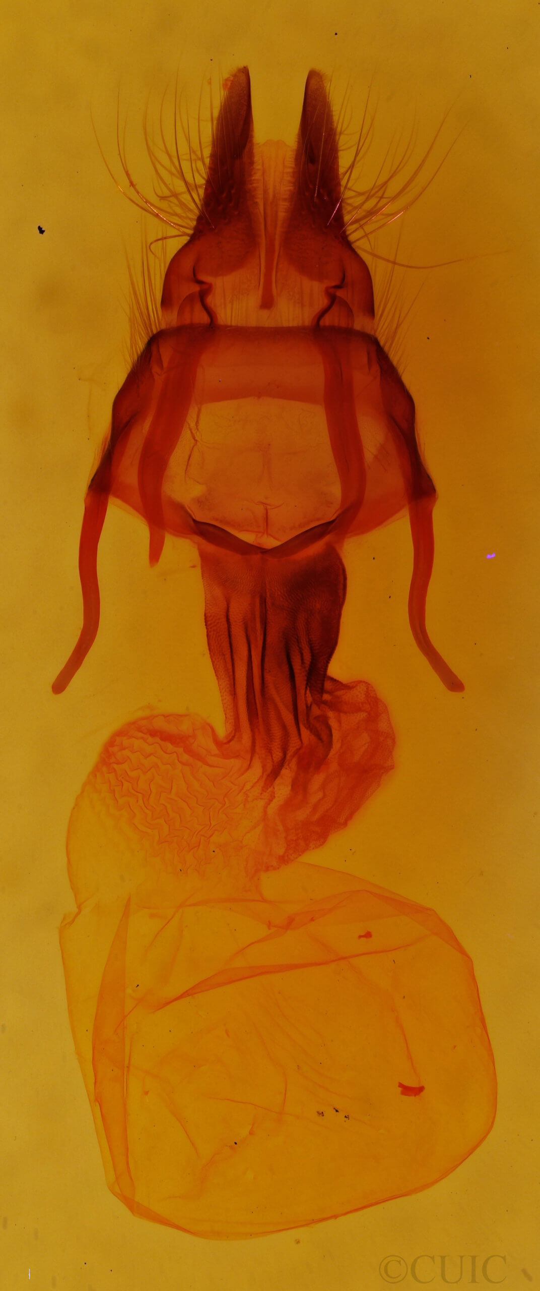 genitalia view of adult Apamea vulgaris