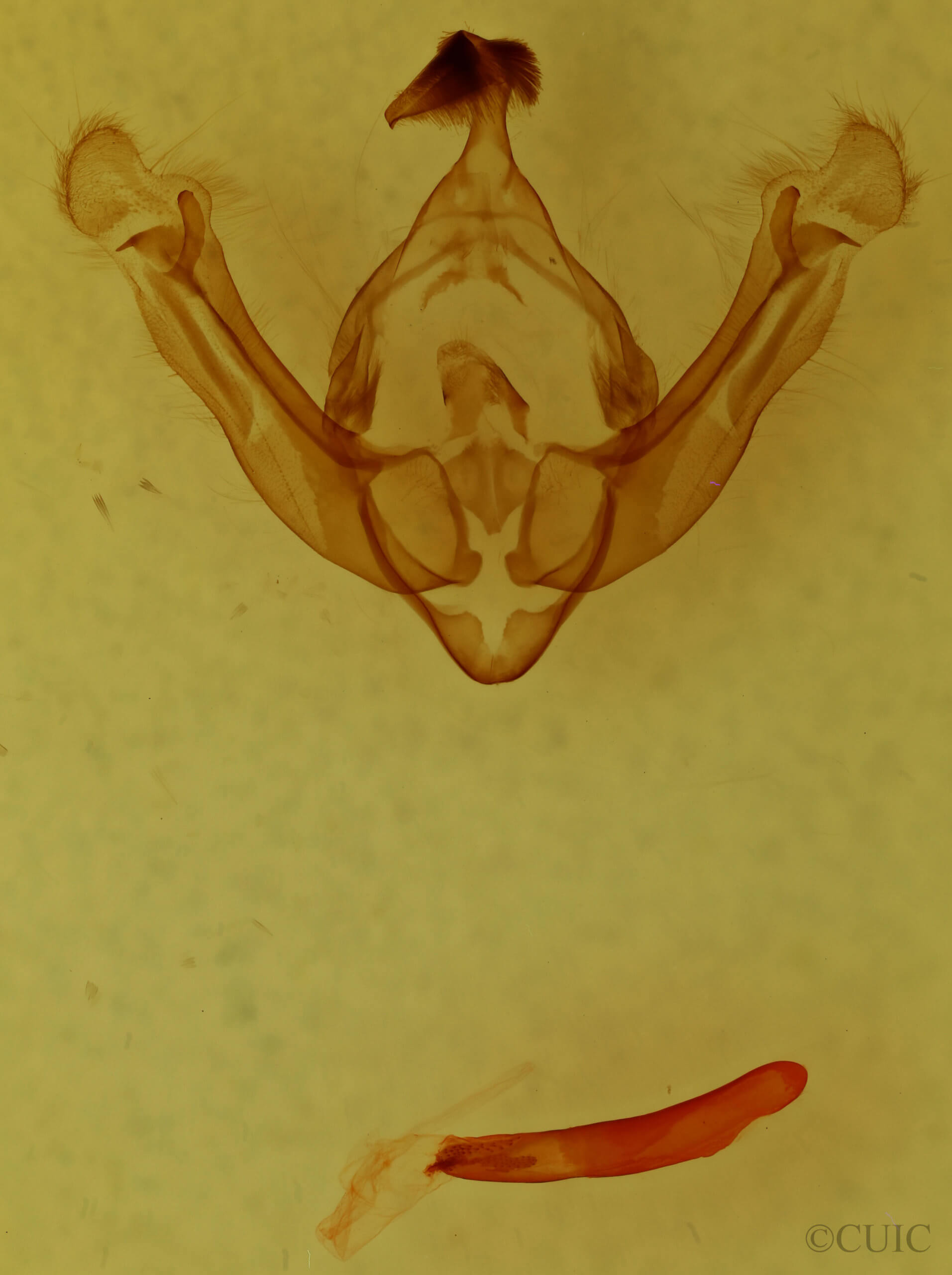 genitalia view of adult Globia alameda