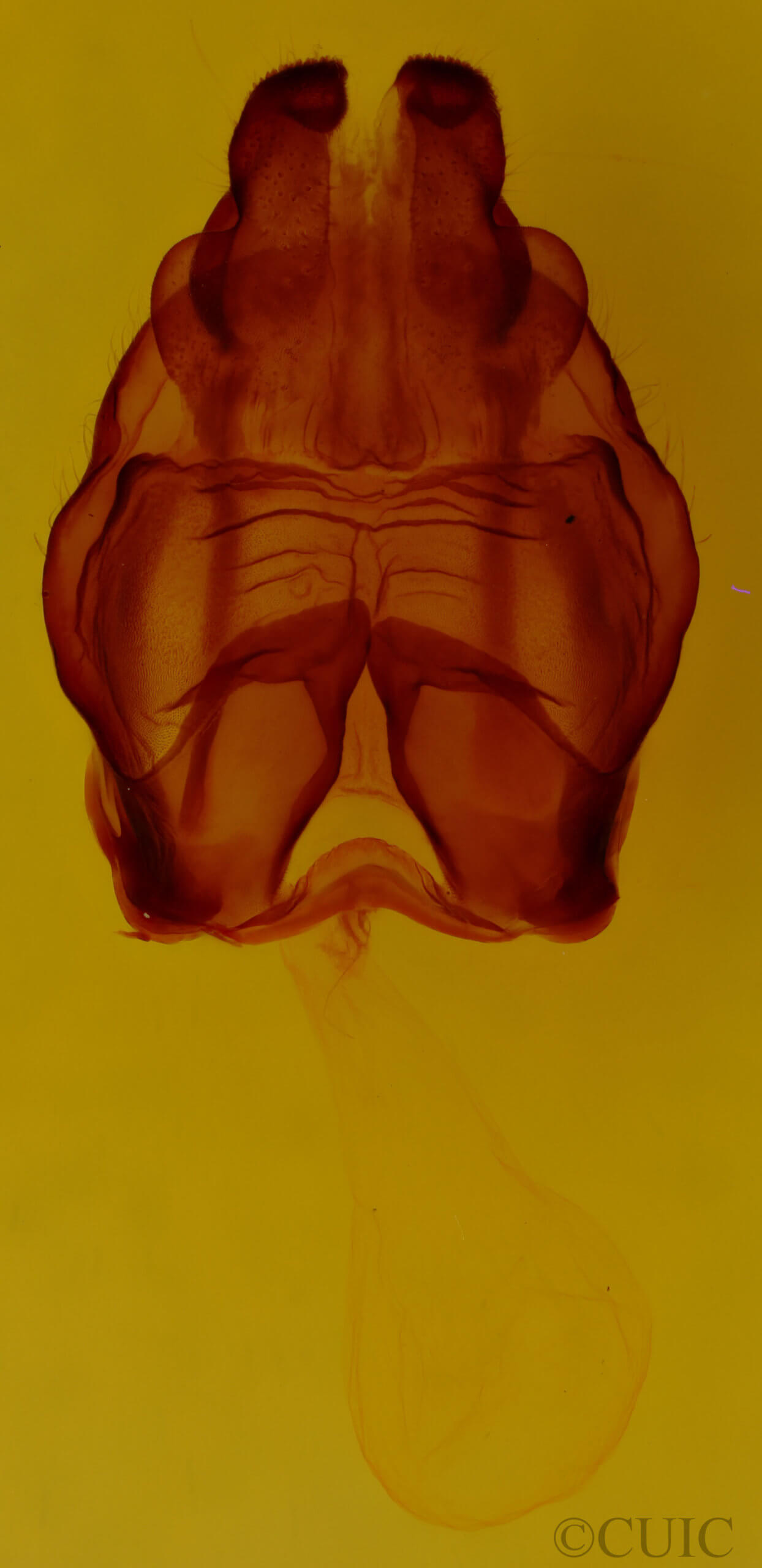 genitalia view of adult Globia alameda