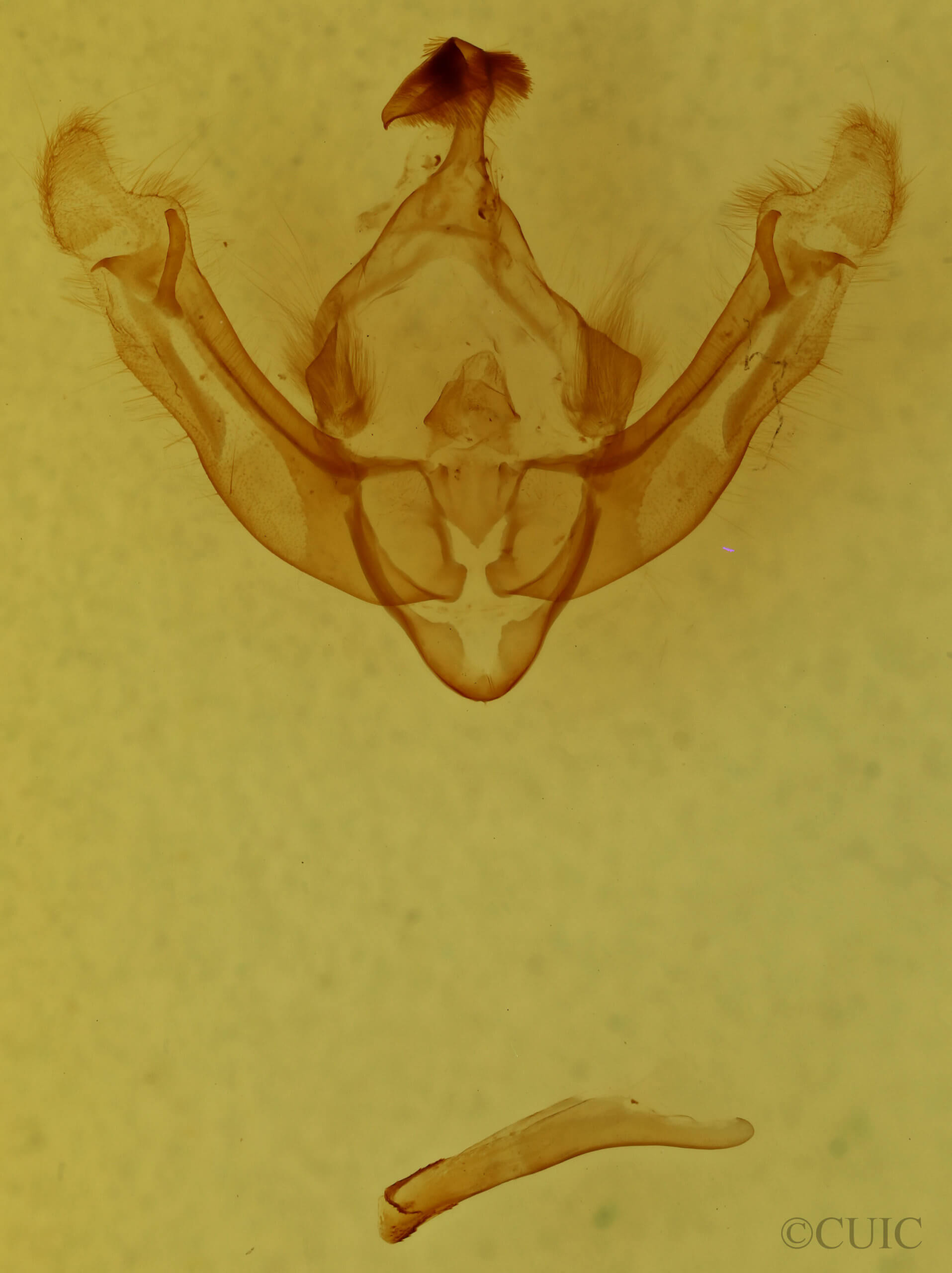 genitalia view of adult Globia alameda