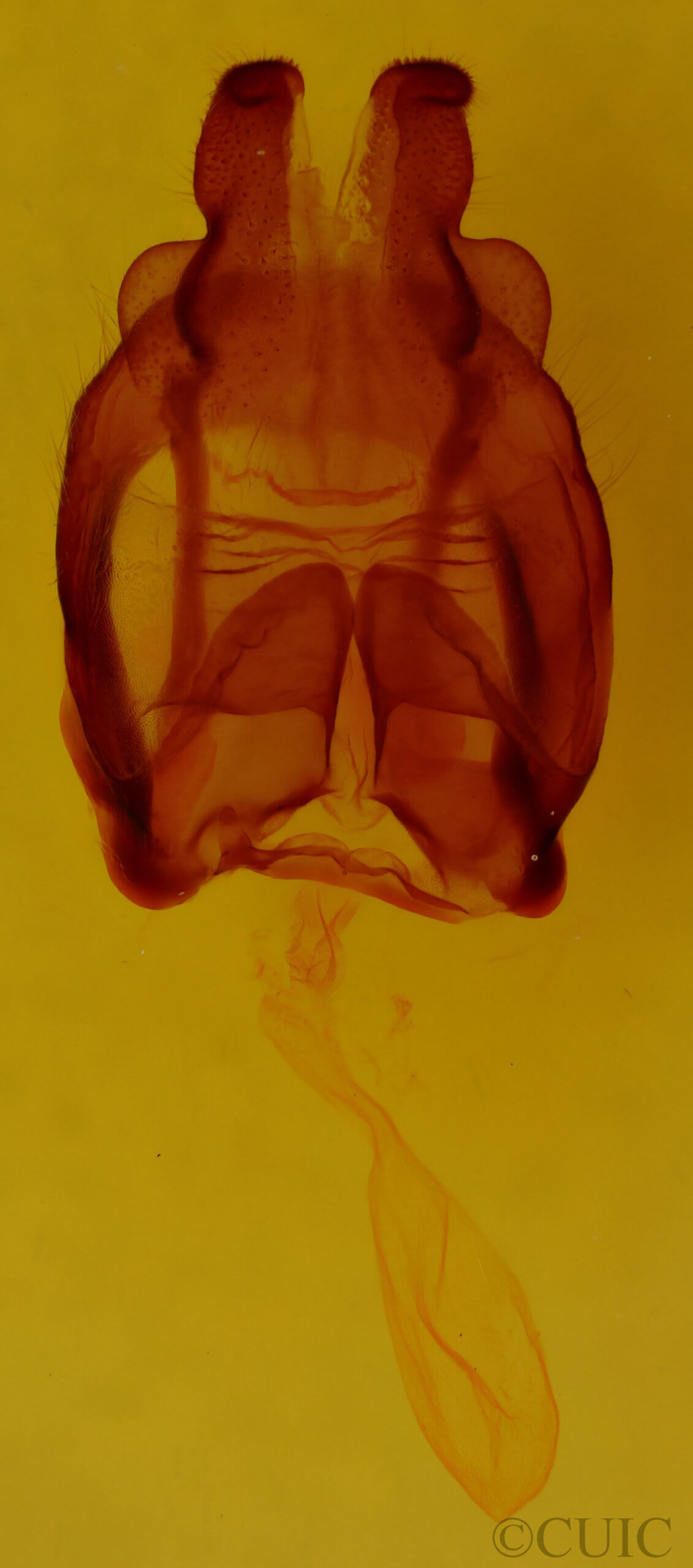 genitalia view of adult Globia alameda