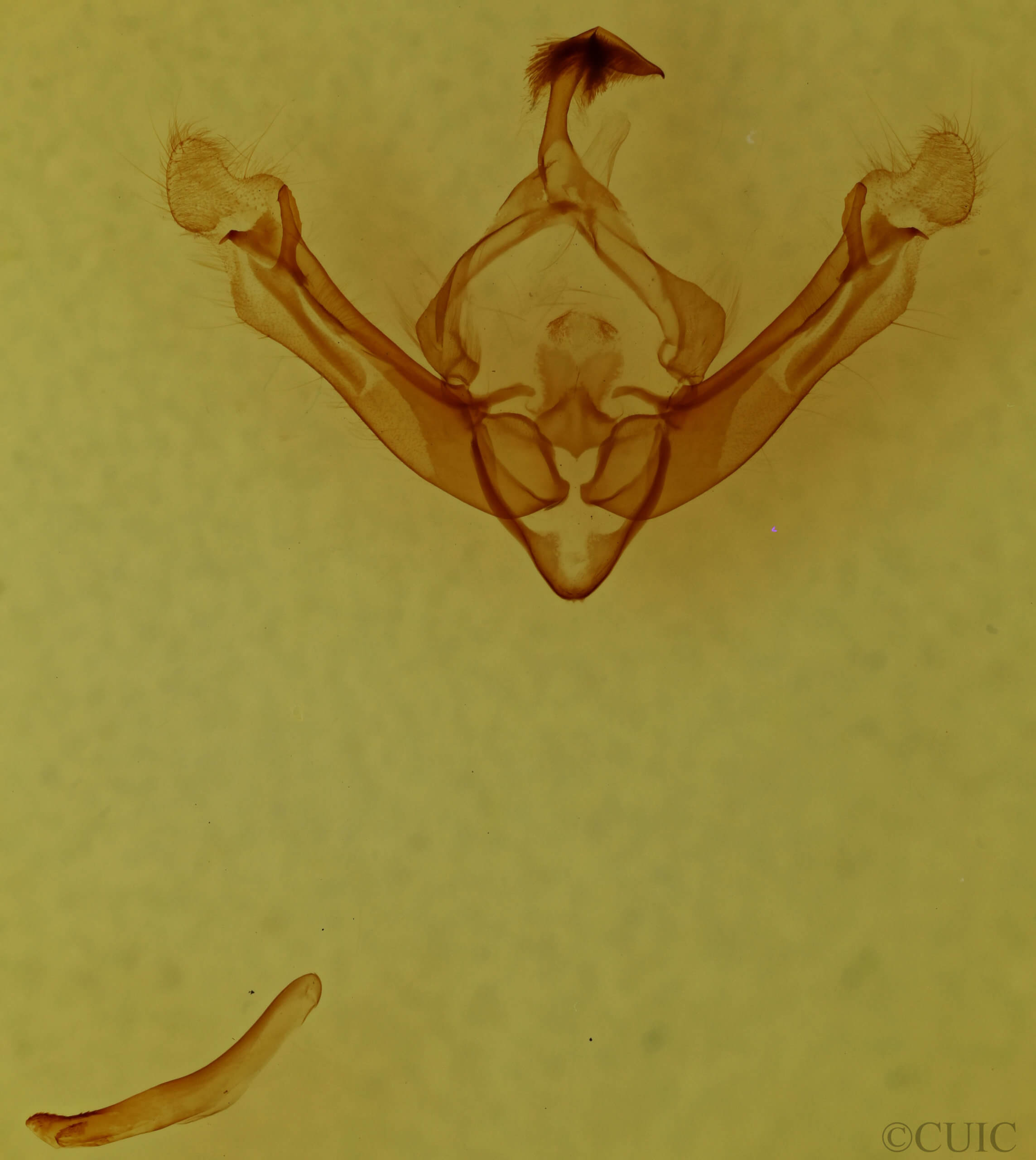 genitalia view of adult Globia alameda