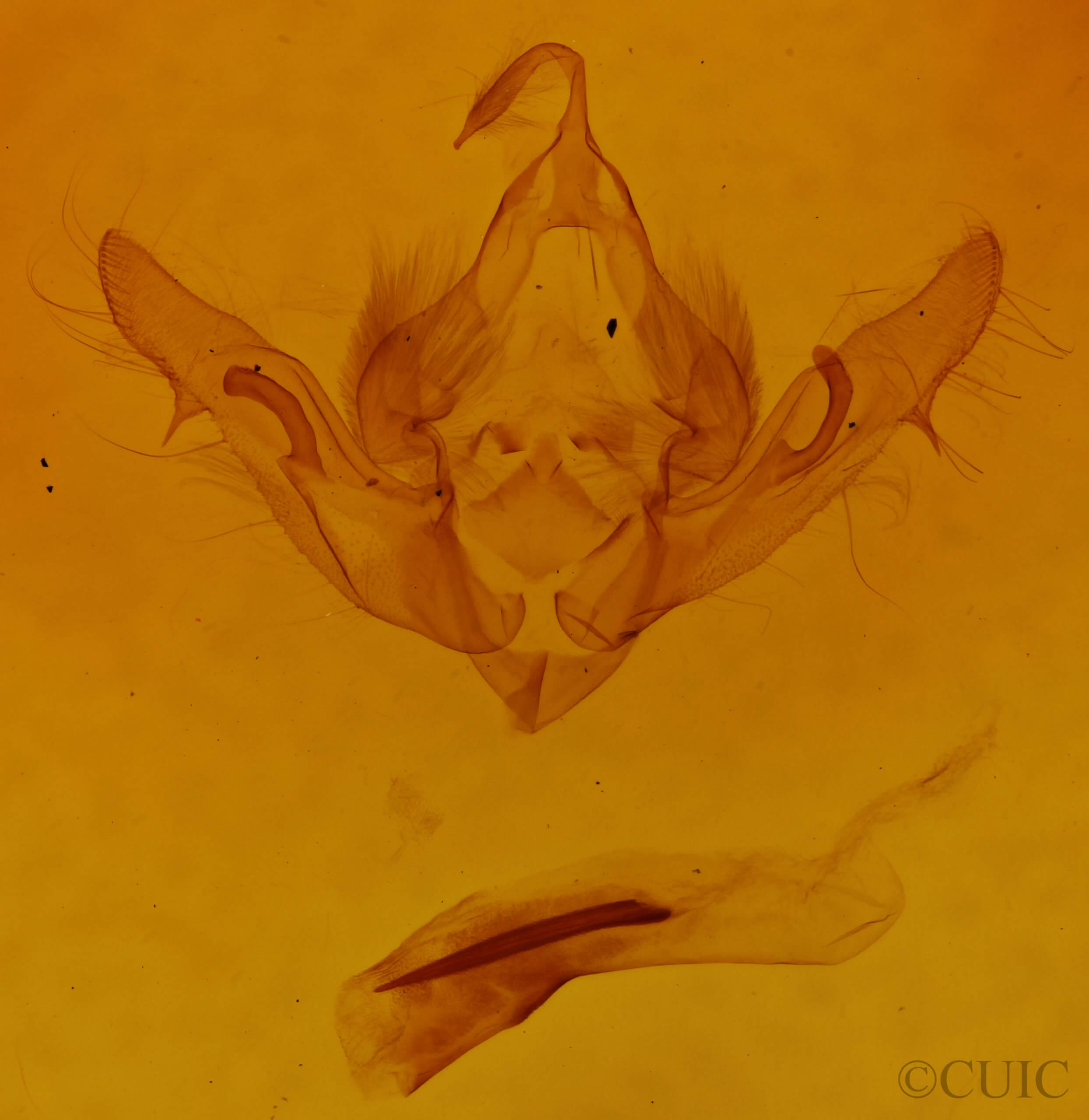 genitalia view of adult Aseptis binotata
