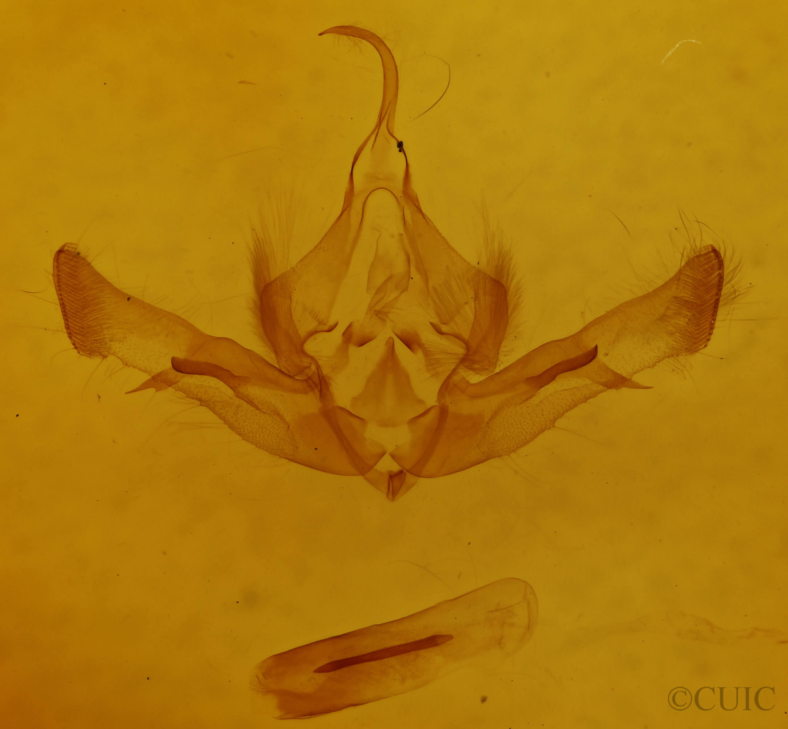 genitalia view of adult Aseptis susquesa