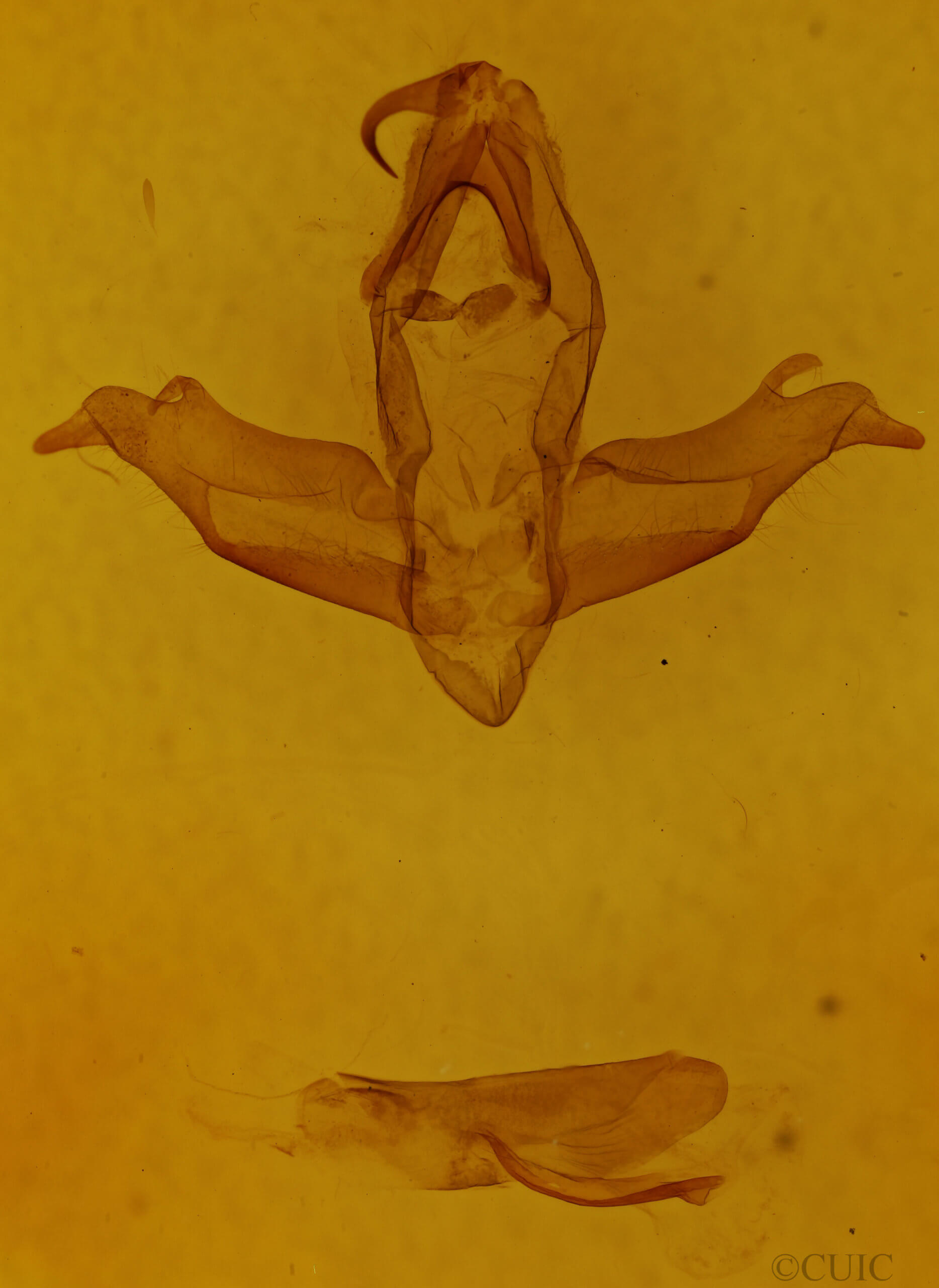 genitalia view of adult Ceroctena