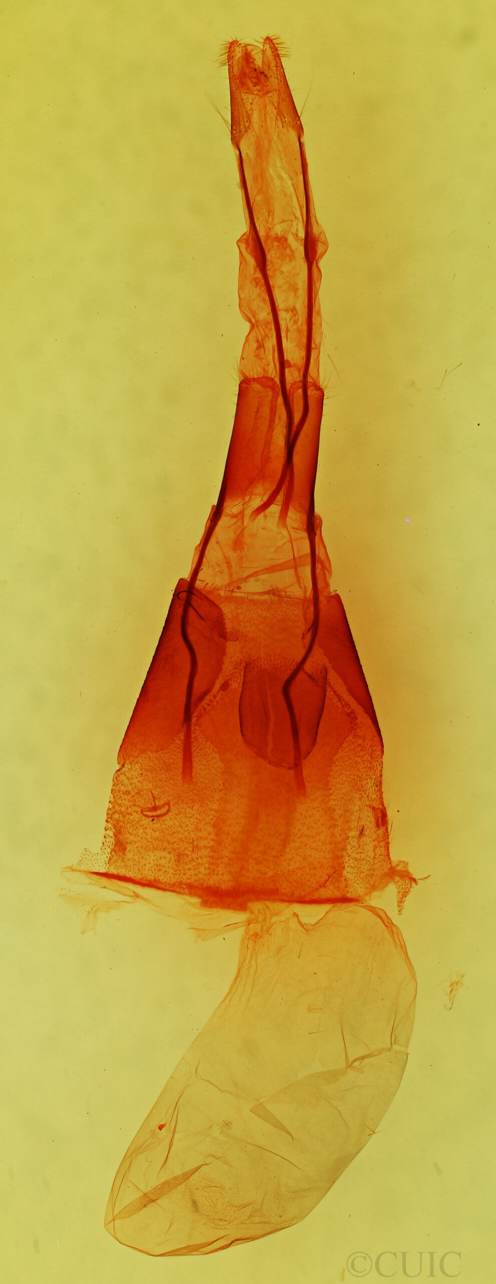 genitalia view of adult Supralathosea  pronuba