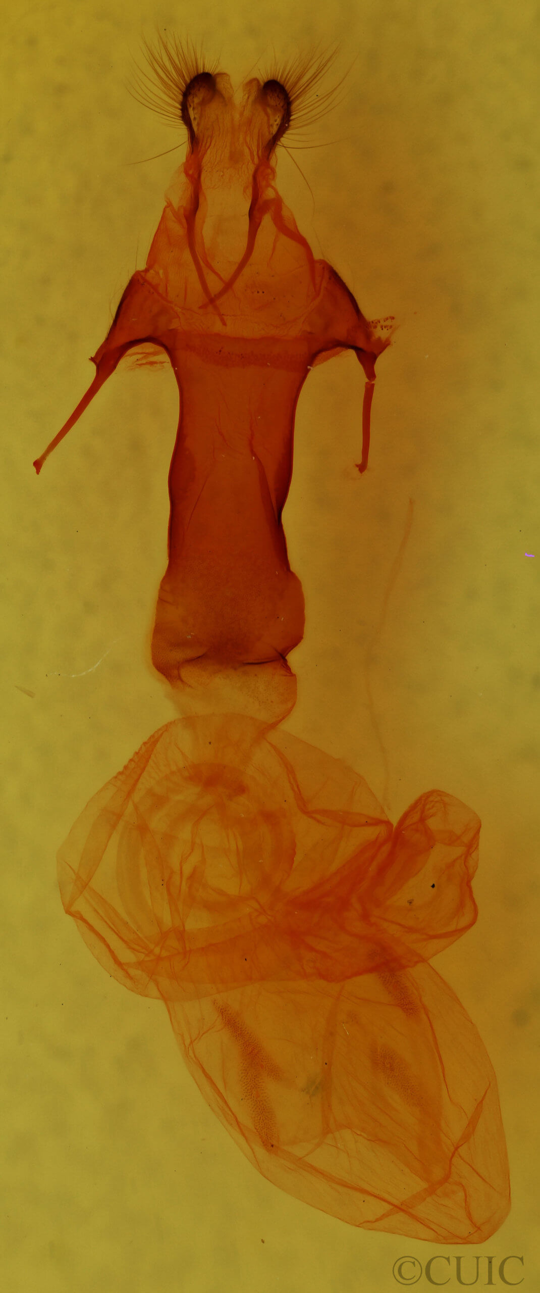 genitalia view of adult Egira baueri