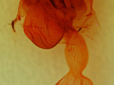 genitalia view of adult Egira conspicillaris