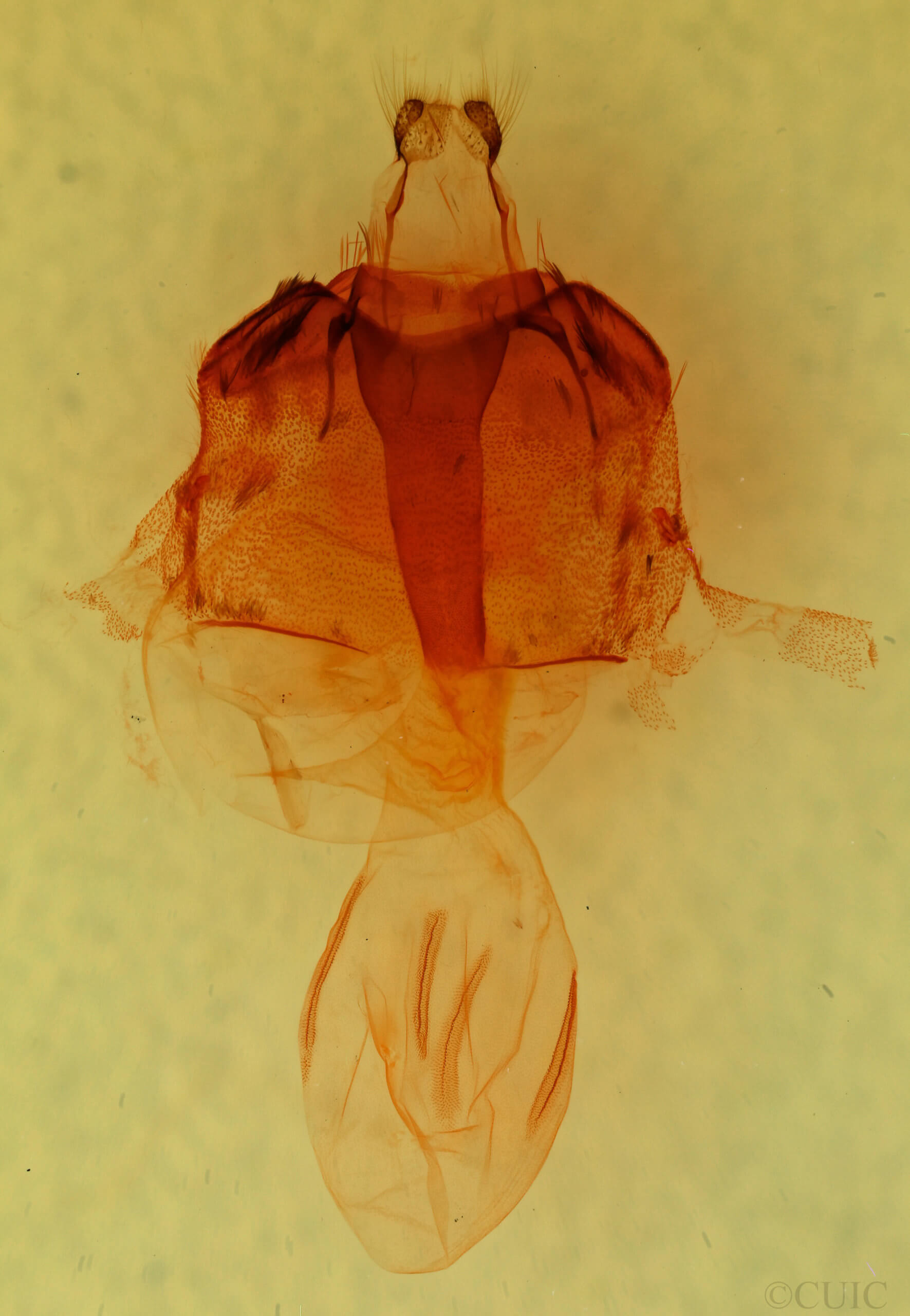 genitalia view of adult Egira hiemalis