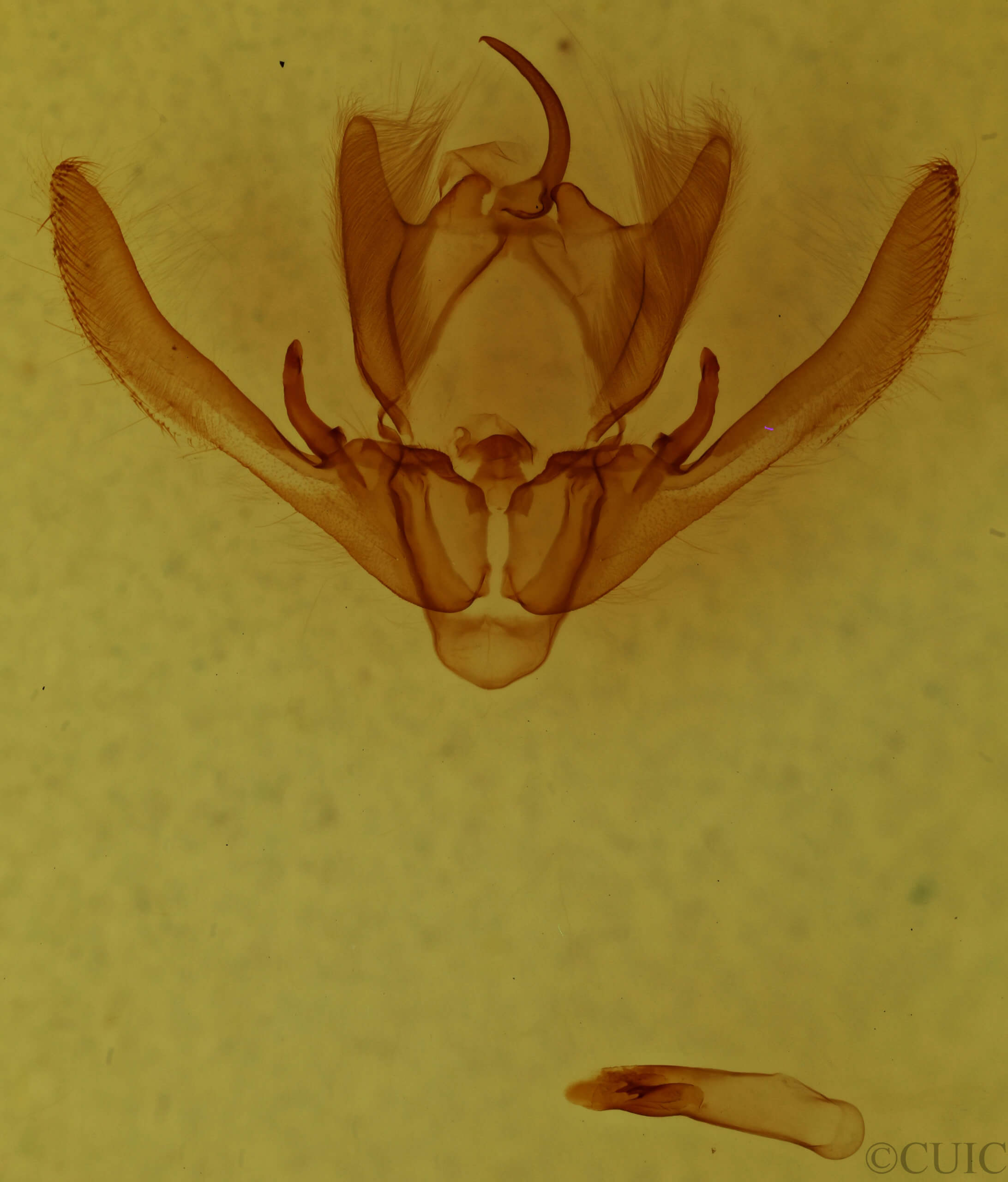 genitalia view of adult Enargia infumata