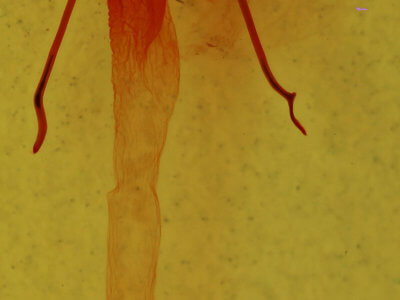 genitalia view of adult Enargia infumata