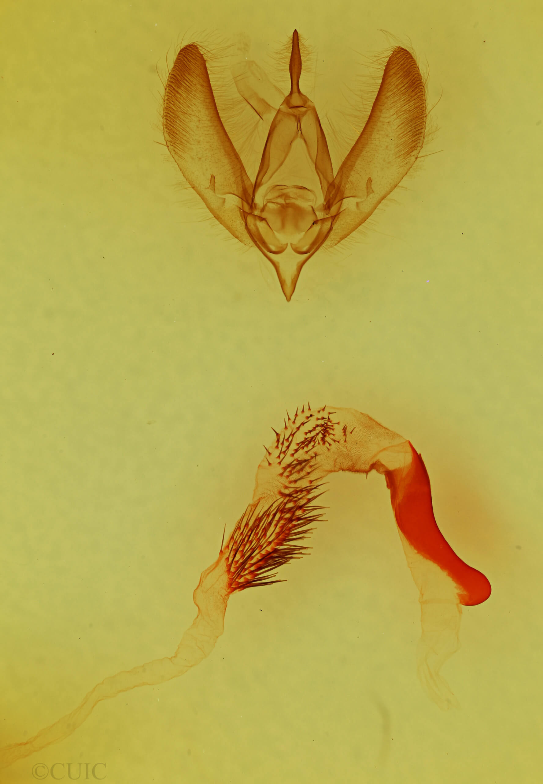 genitalia view of adult Euamiana contrasta