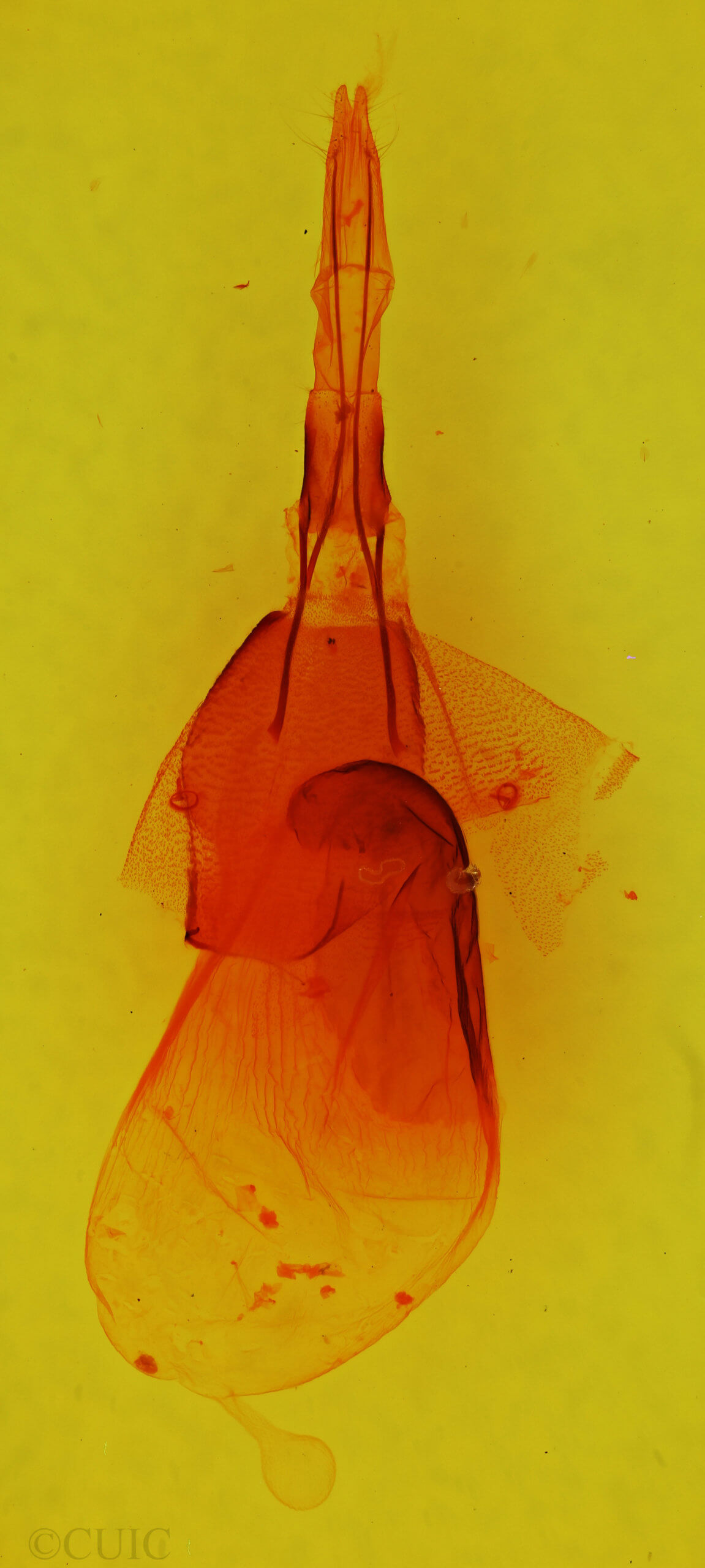 genitalia view of adult Euamiana dissimilis