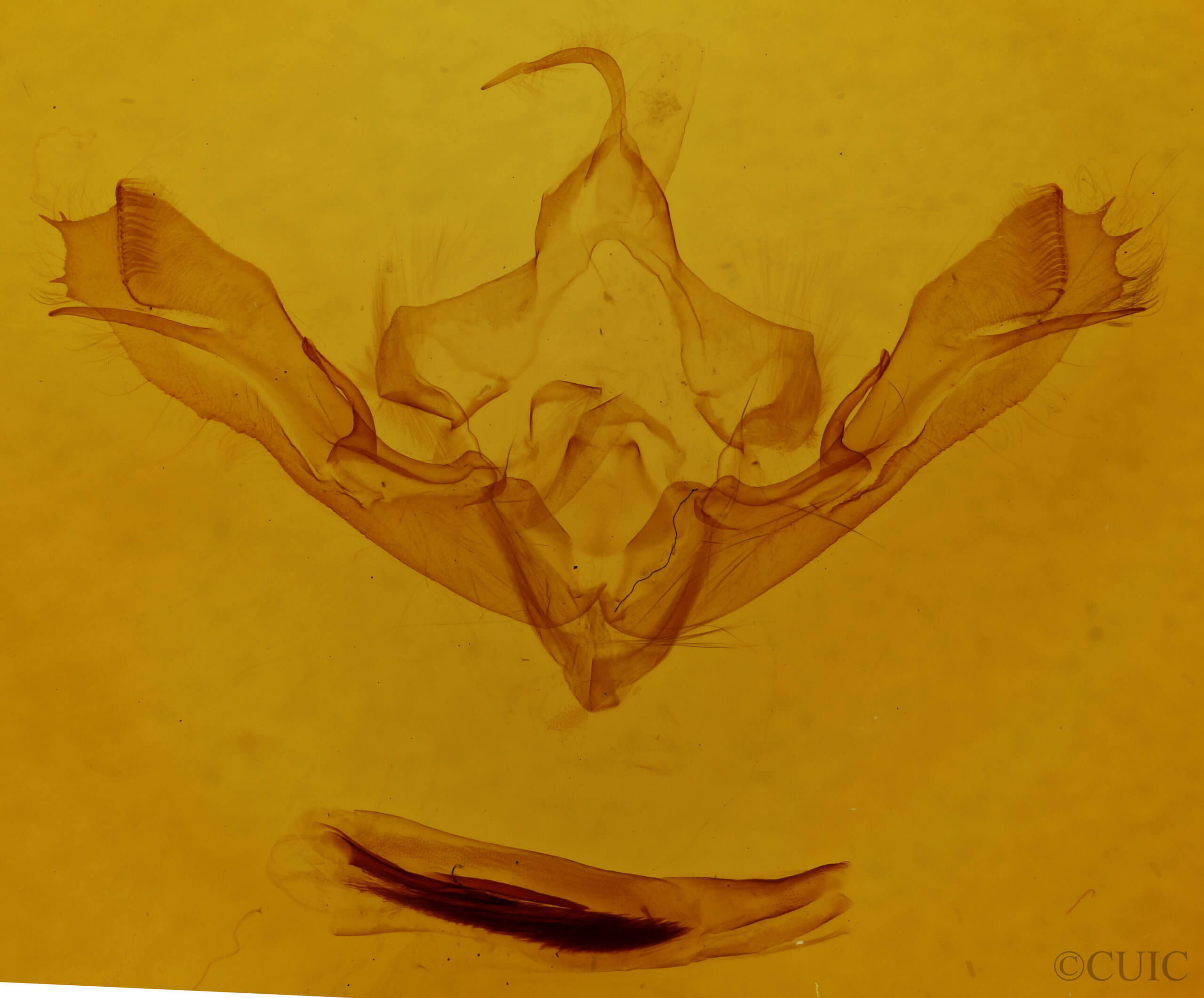 genitalia view of adult Dryobotodes eremita