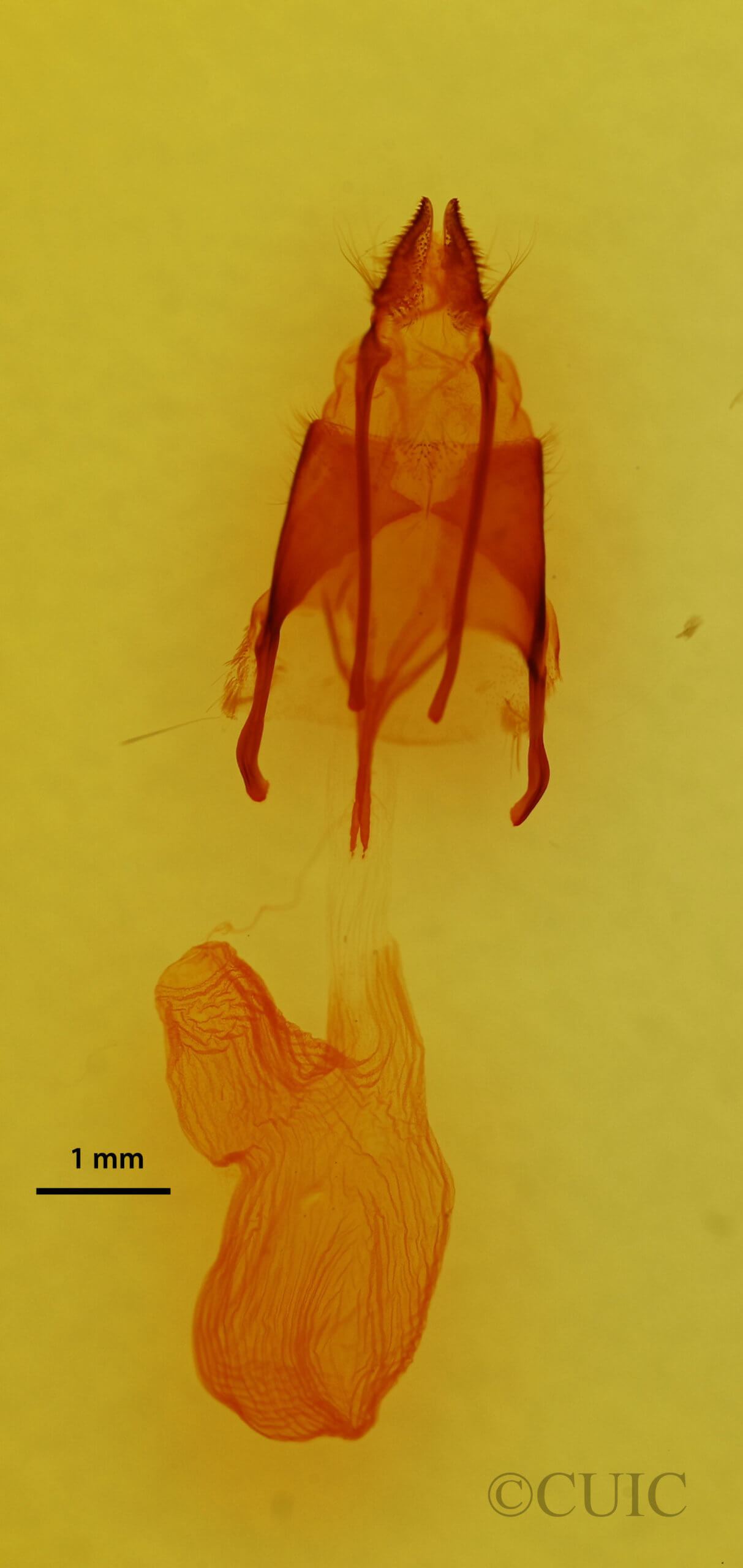 genitalia view of adult Euxoa costata