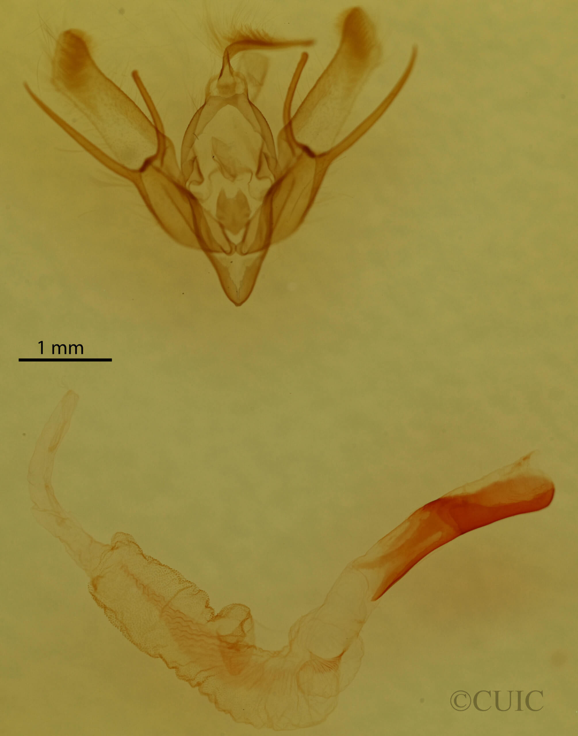 genitalia view of adult Euxoa redimicula