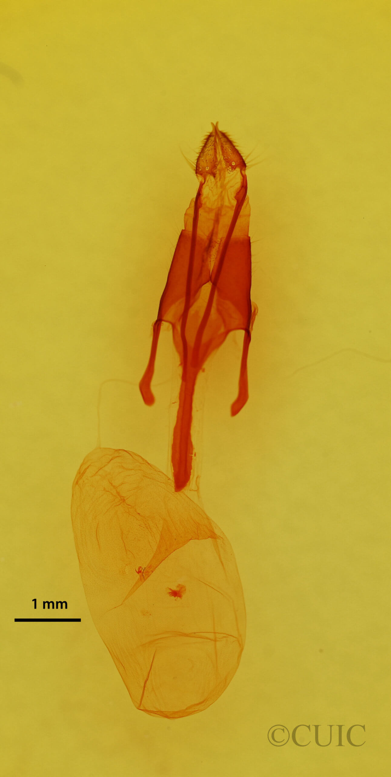 genitalia view of adult Euxoa redimicula