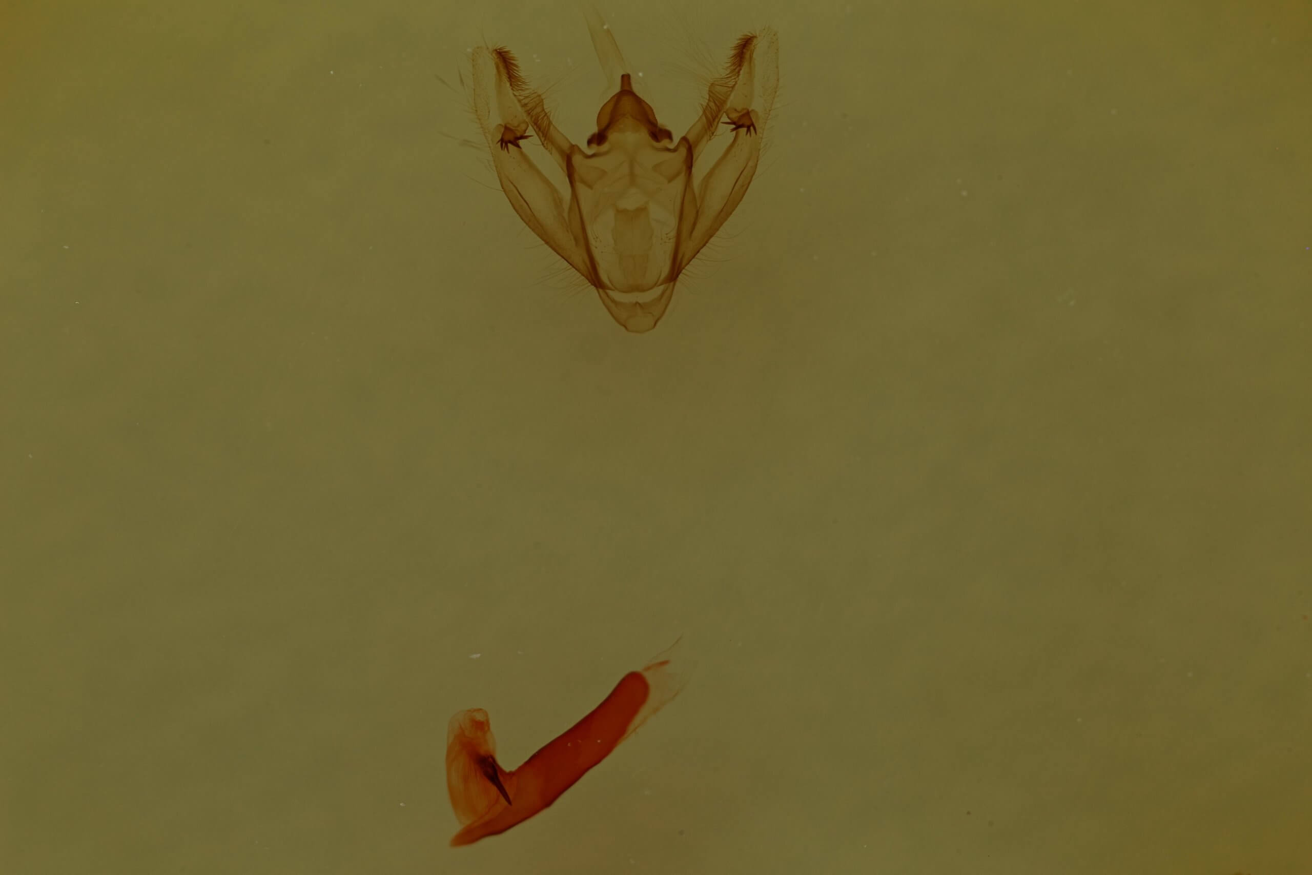 genitalia view of adult Galenara lallata