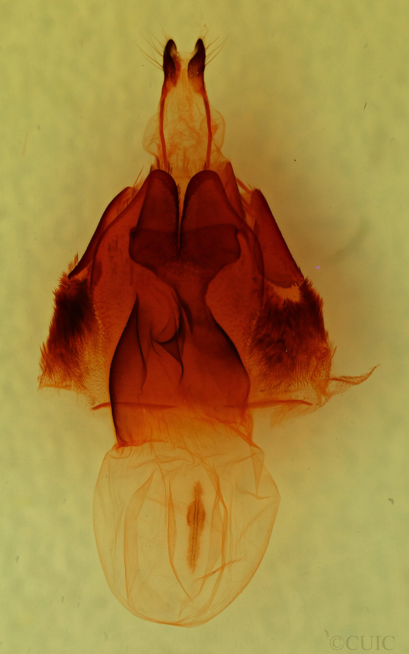 genitalia view of adult Hadena lafontainei