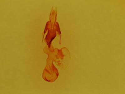 genitalia view of adult Hemibryomima chryselectra