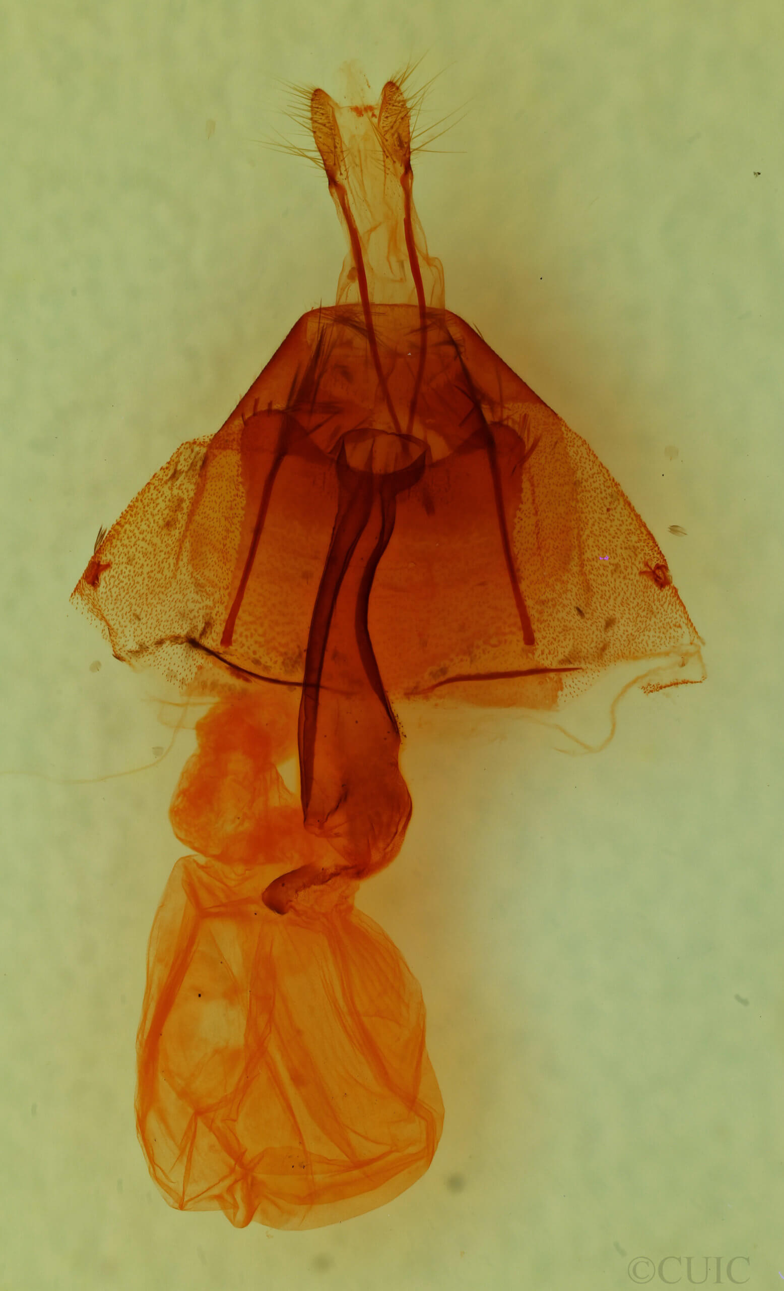 genitalia view of adult Lacinipolia luteimacula