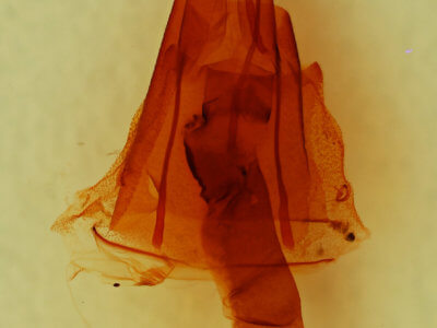 genitalia view of adult Lacinipolia  delongi