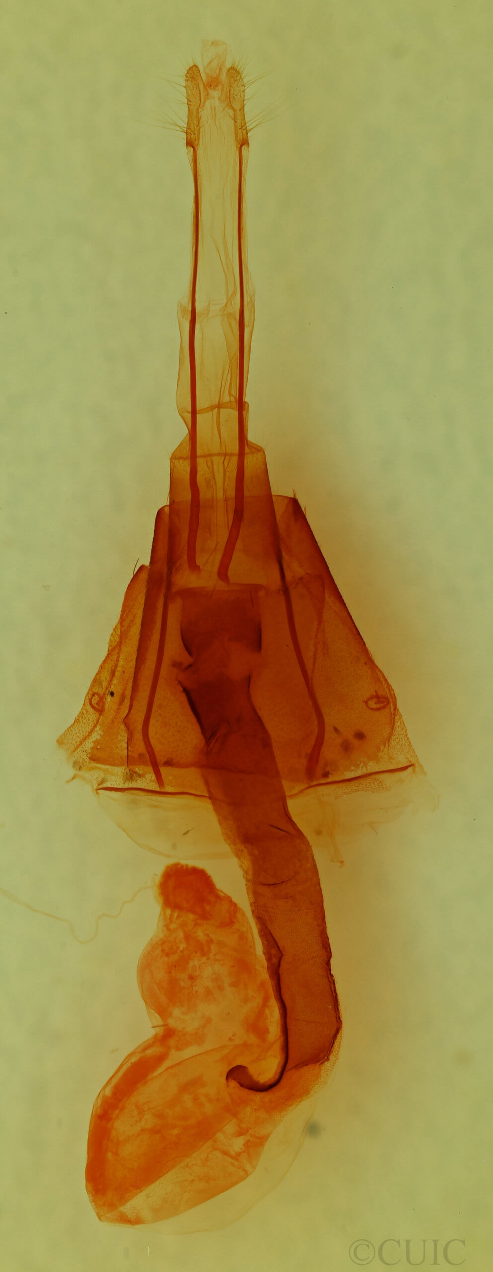 genitalia view of adult Lacinipolia delongi