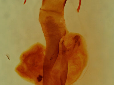 genitalia view of adult Lacinipolia incurva