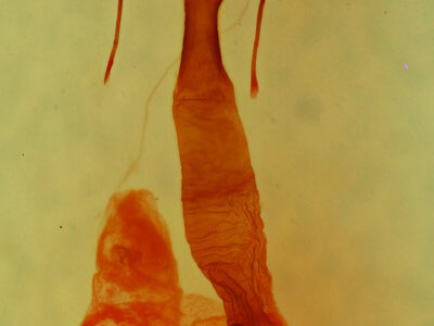 genitalia view of adult Lacinipolia viridifera