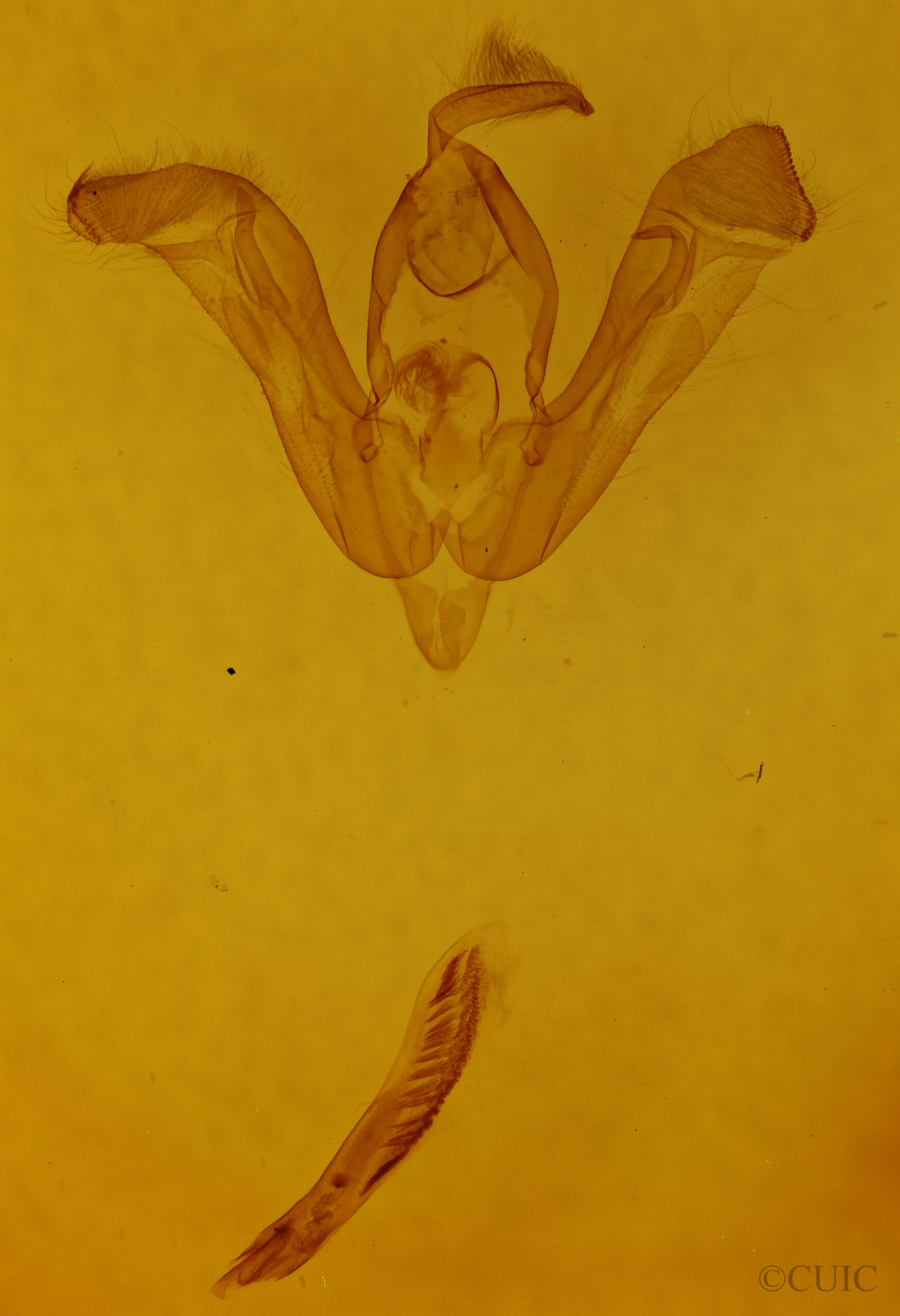 genitalia view of adult Lasionycta