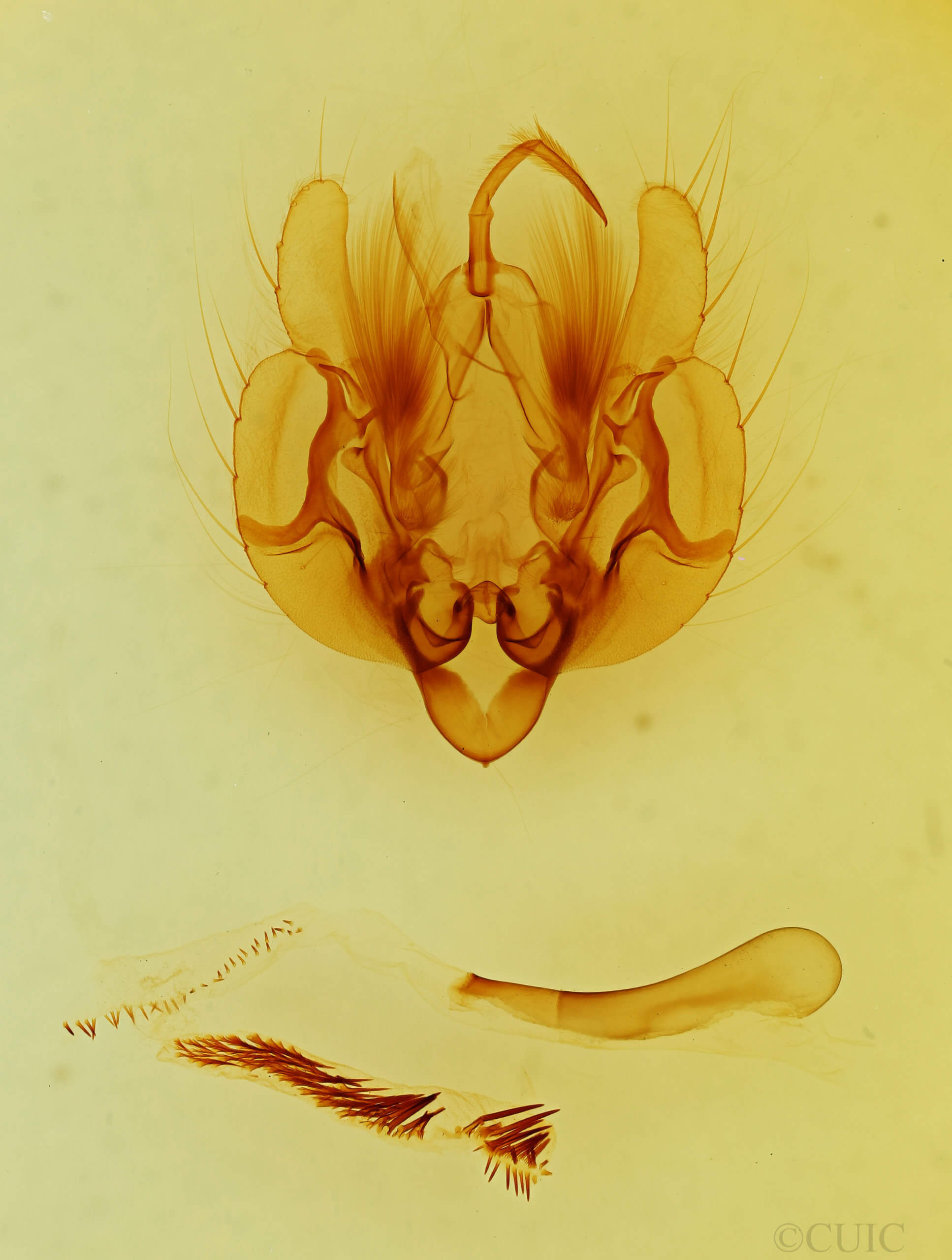 genitalia view of adult Leucania imperfecta